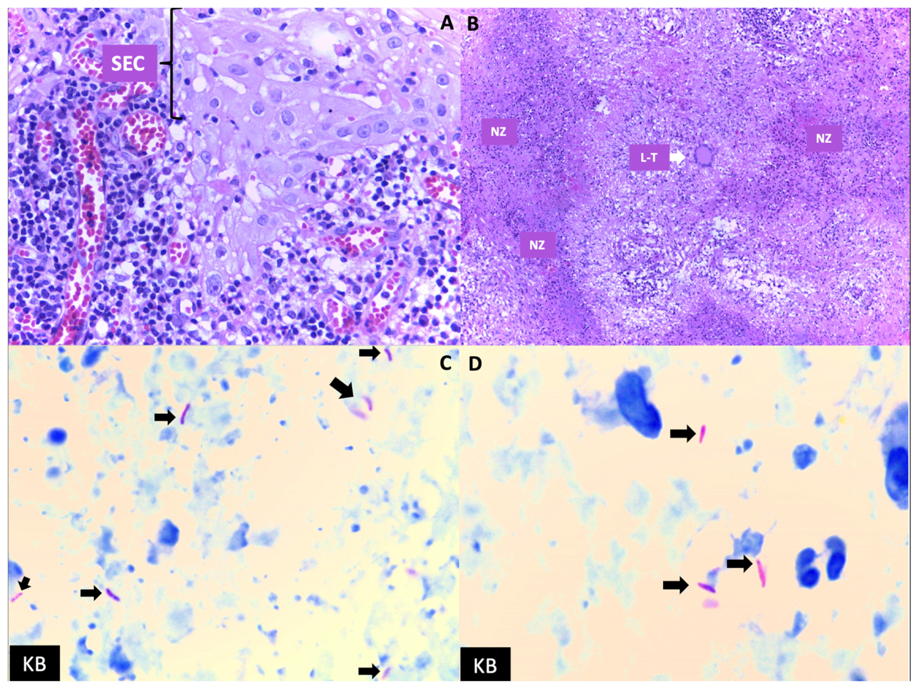 Medicina 60 01282 g002
