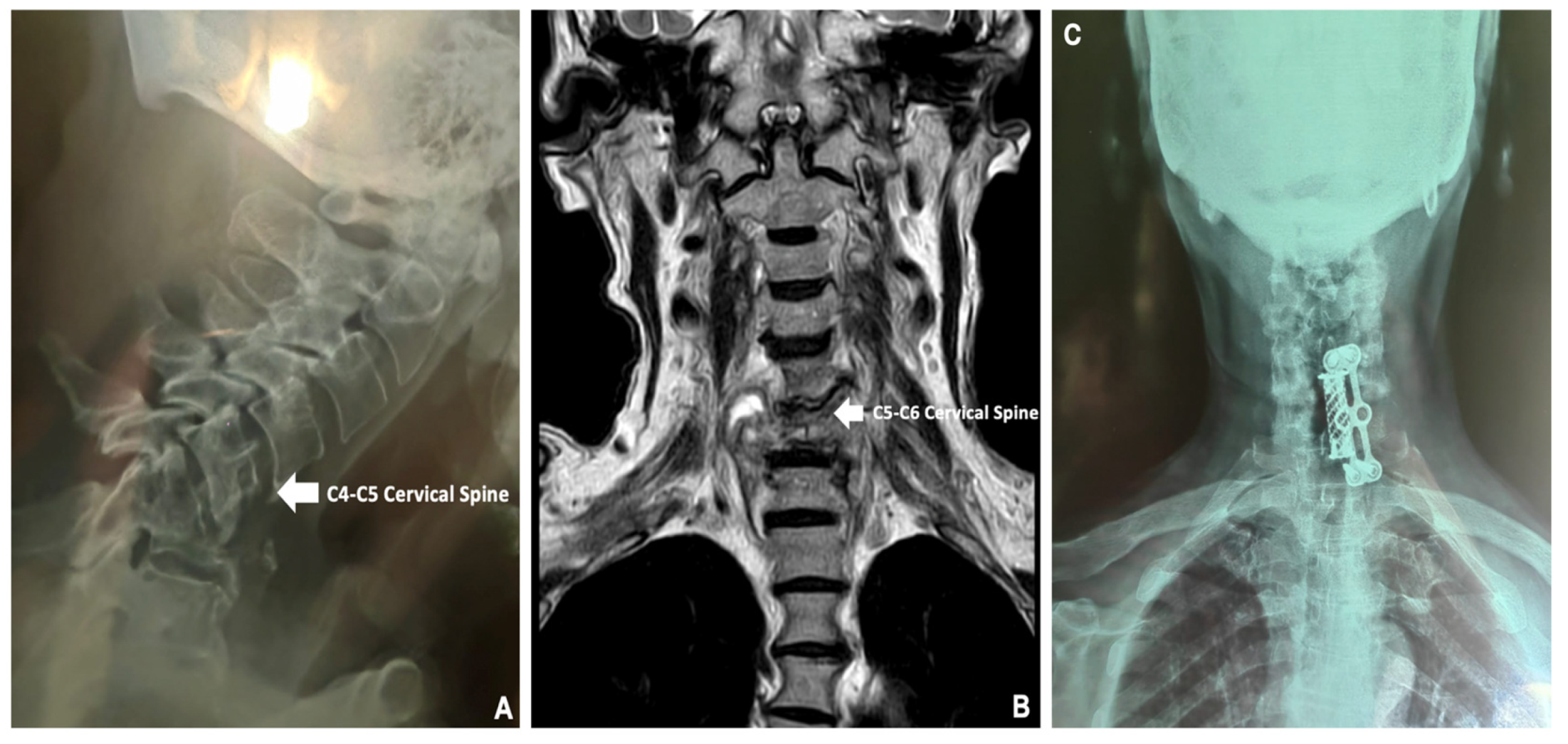 Medicina 60 01282 g003