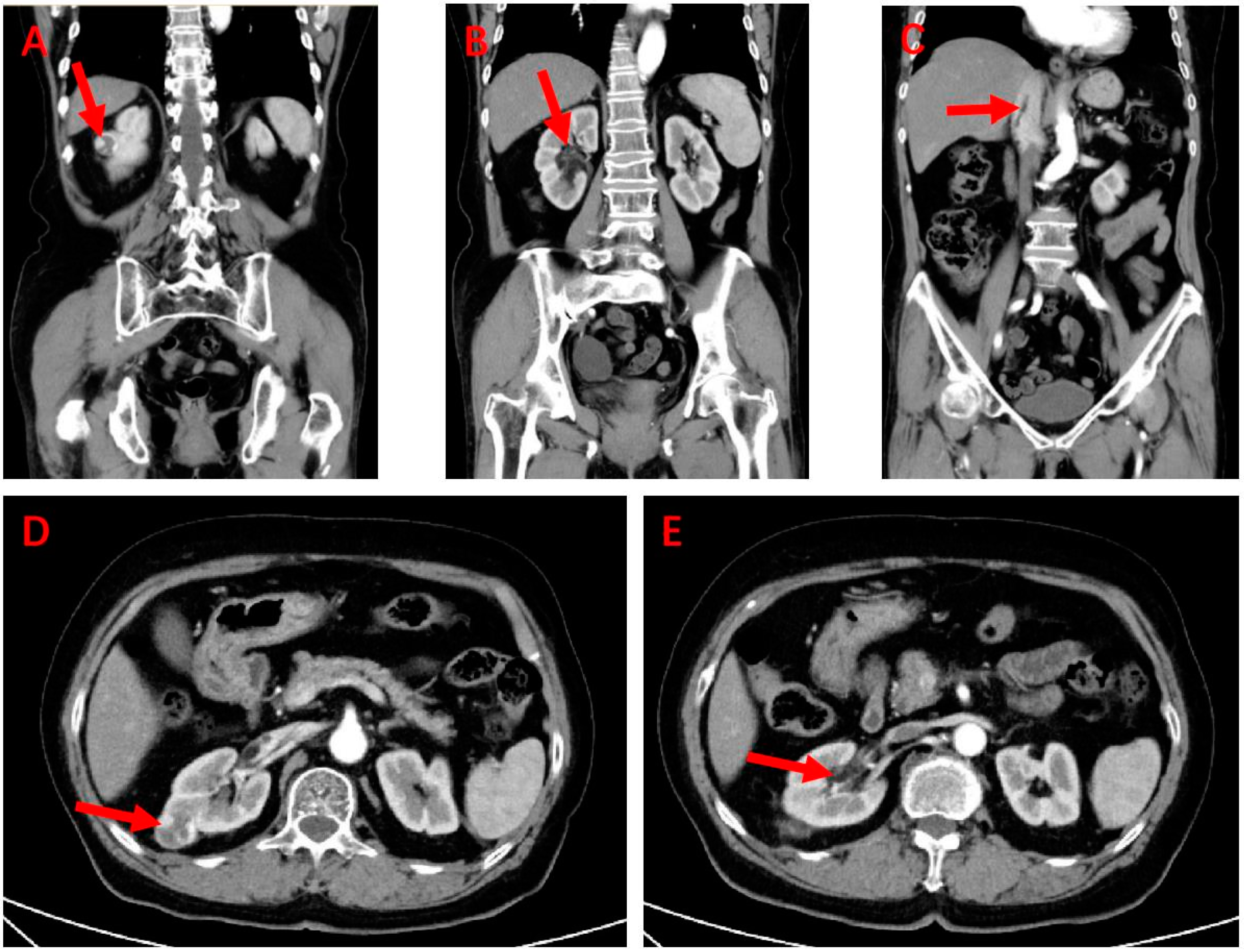 Medicina 60 01293 g001