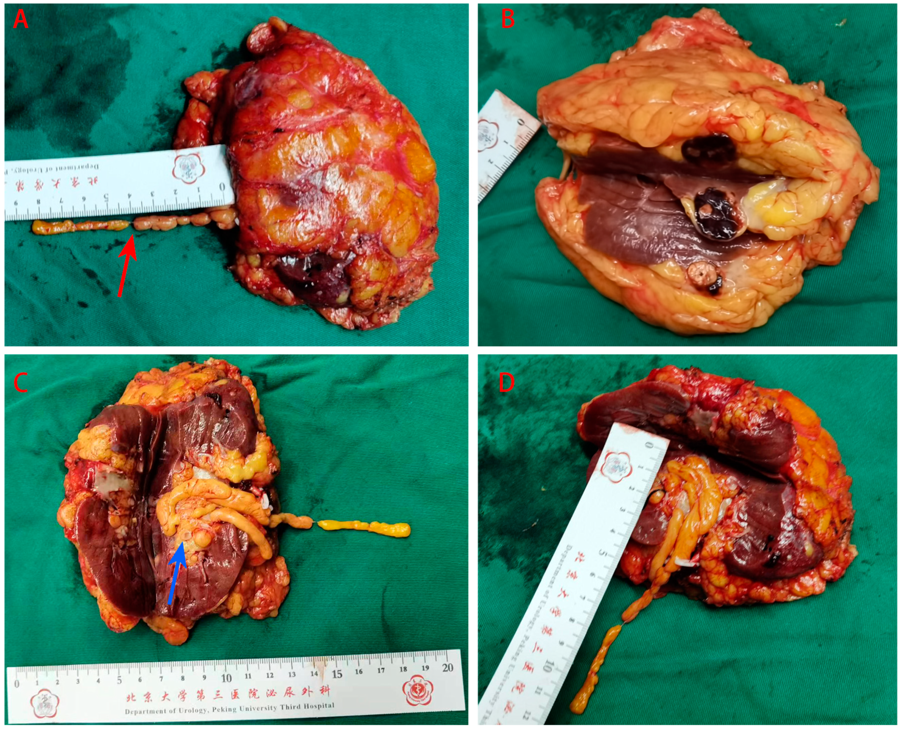 Medicina 60 01293 g003