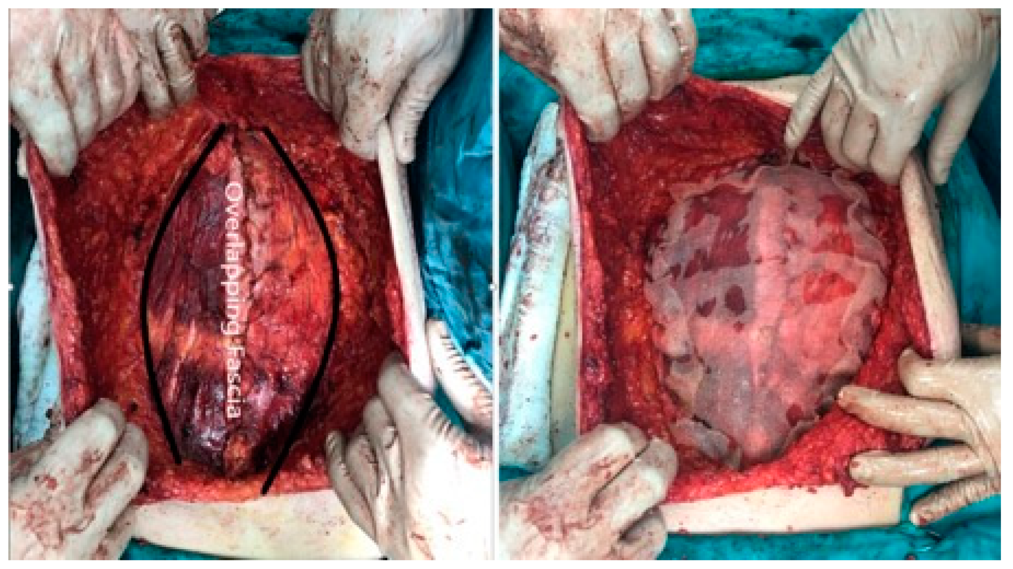 Medicina 60 01328 g001