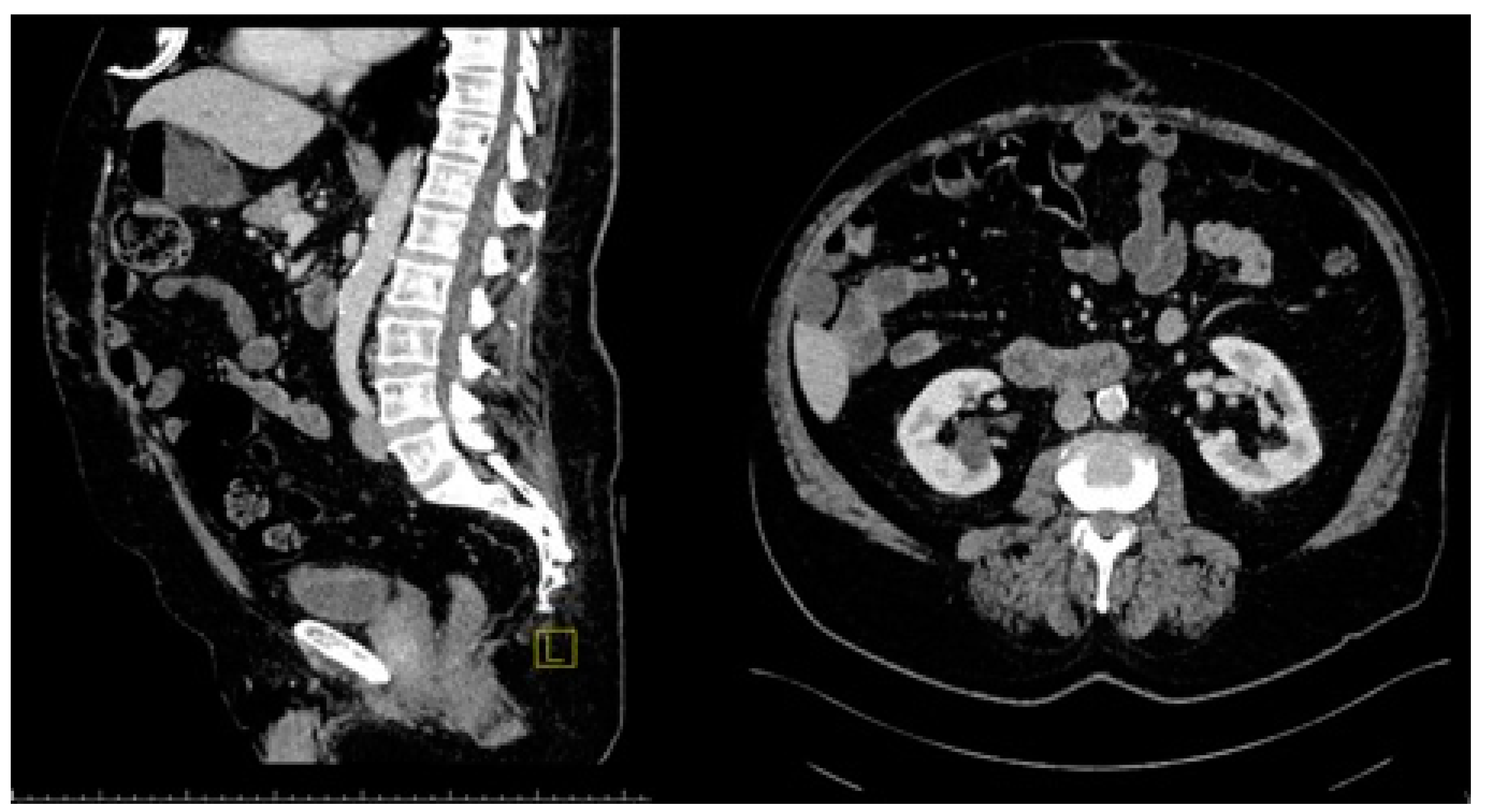 Medicina 60 01328 g002