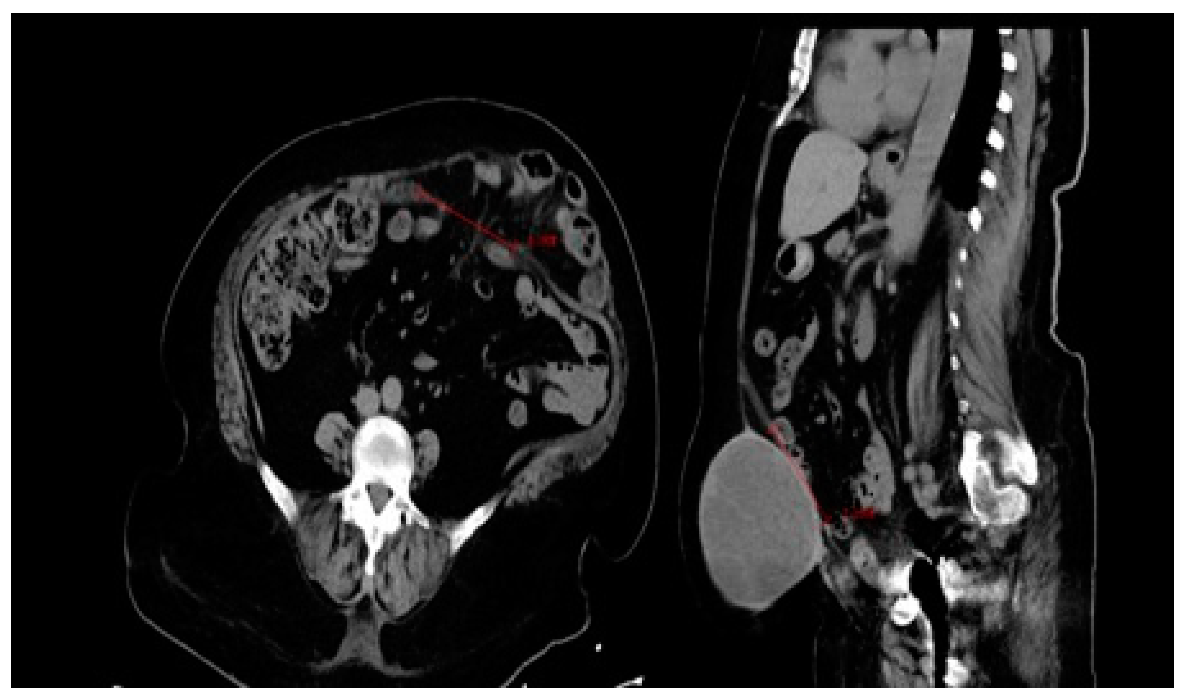Medicina 60 01328 g003