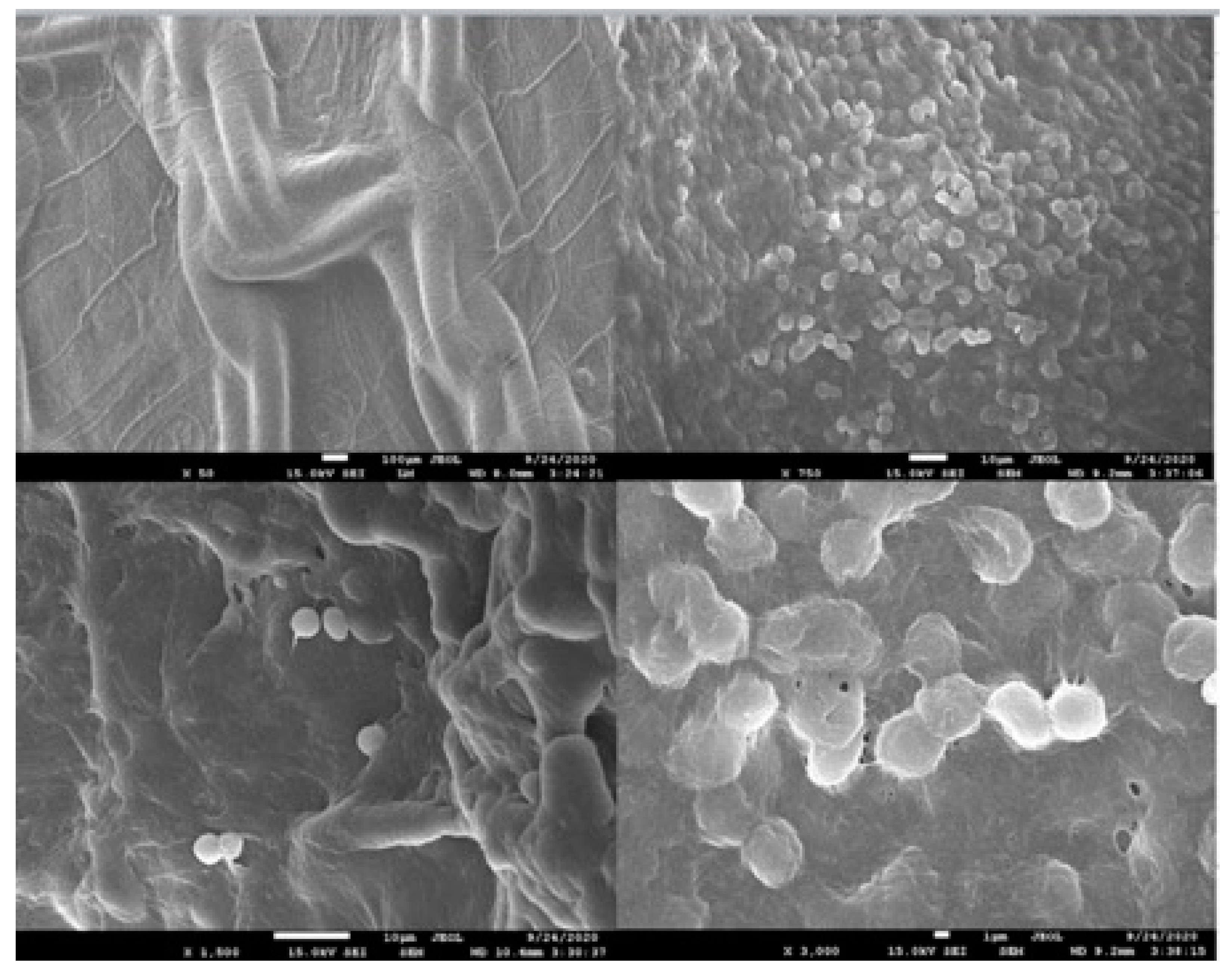 Medicina 60 01328 g004