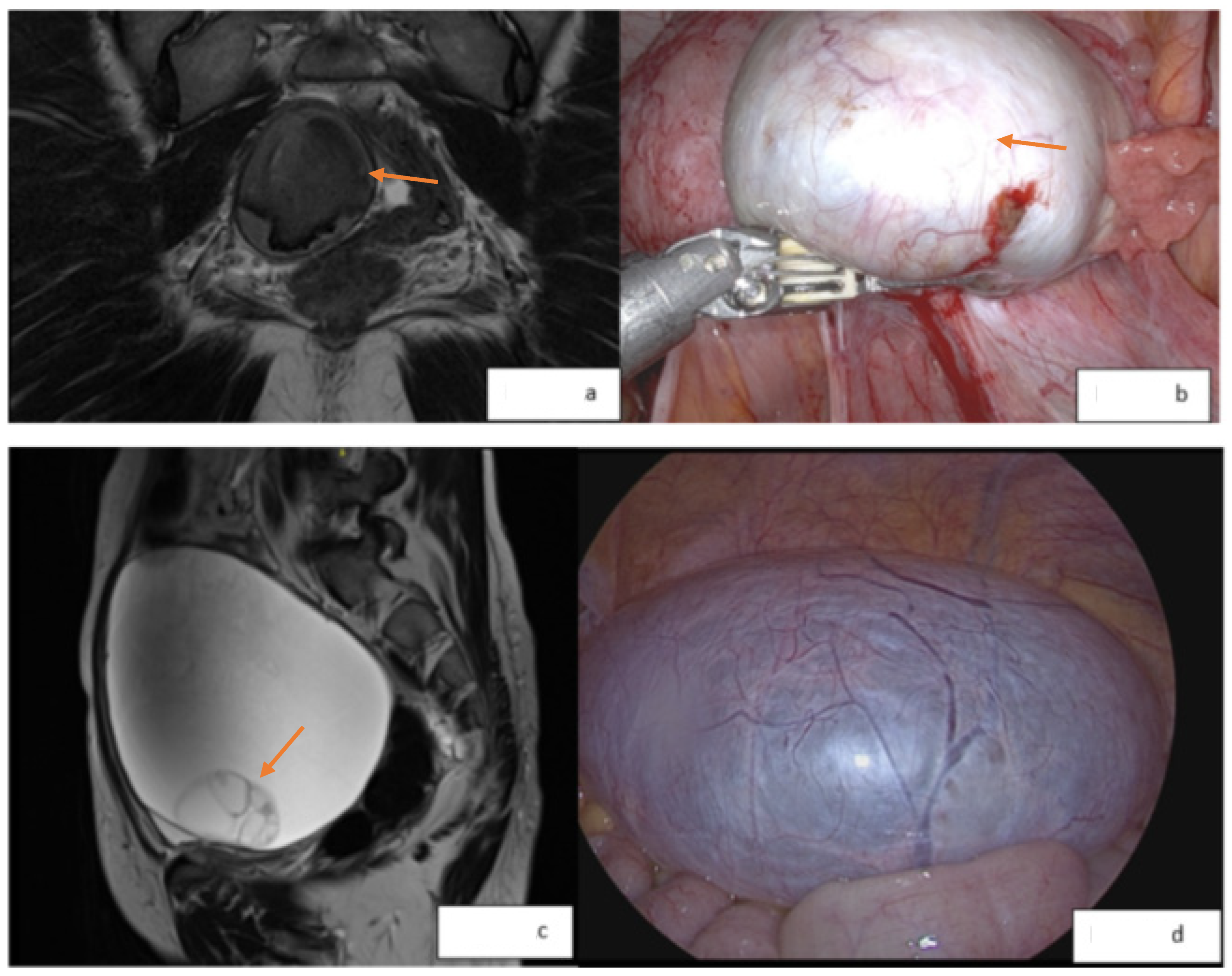 Medicina 60 01341 g001