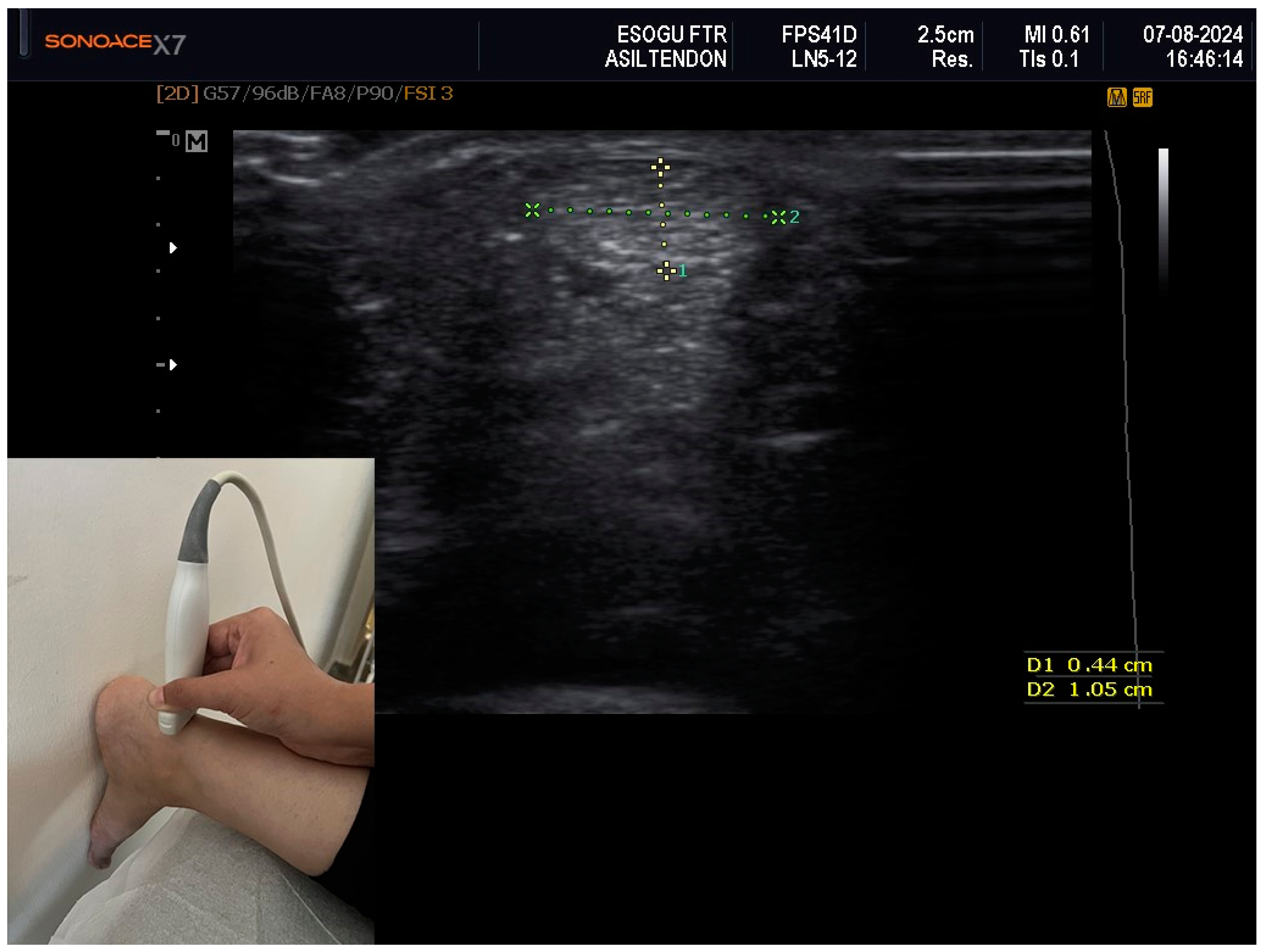 Medicina 60 01349 g001