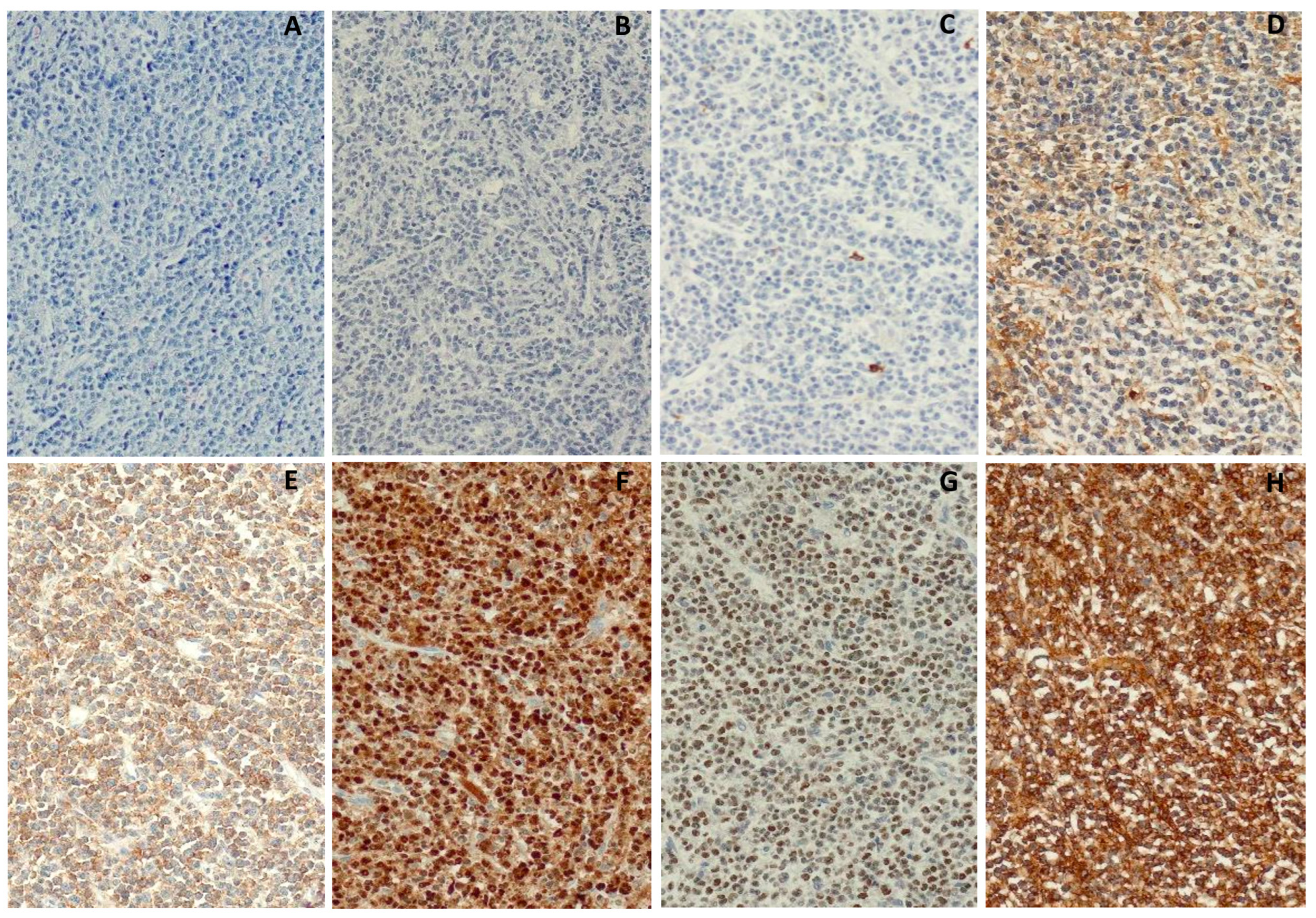 Medicina 60 01351 g004