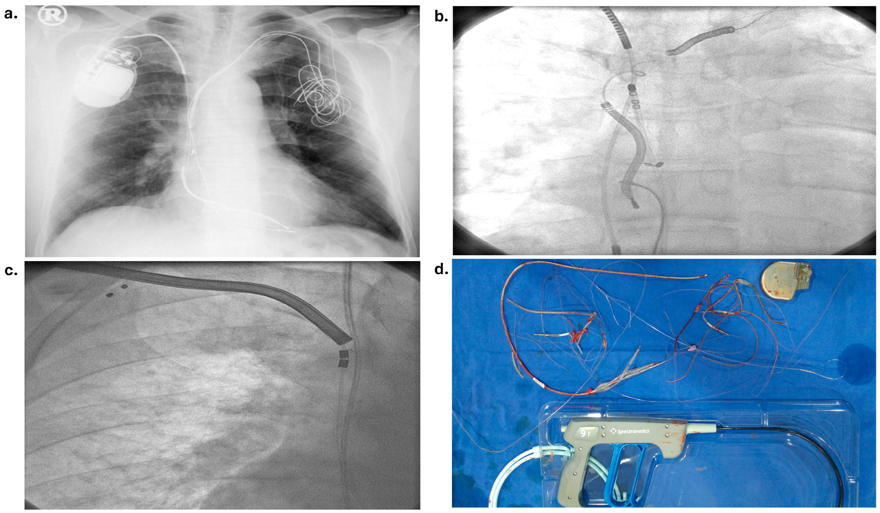 Medicina 60 01360 g002