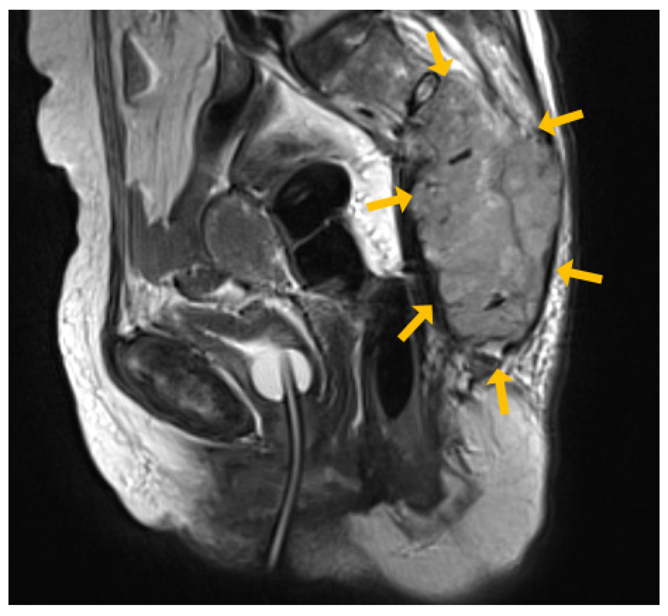 Medicina 60 01365 g003