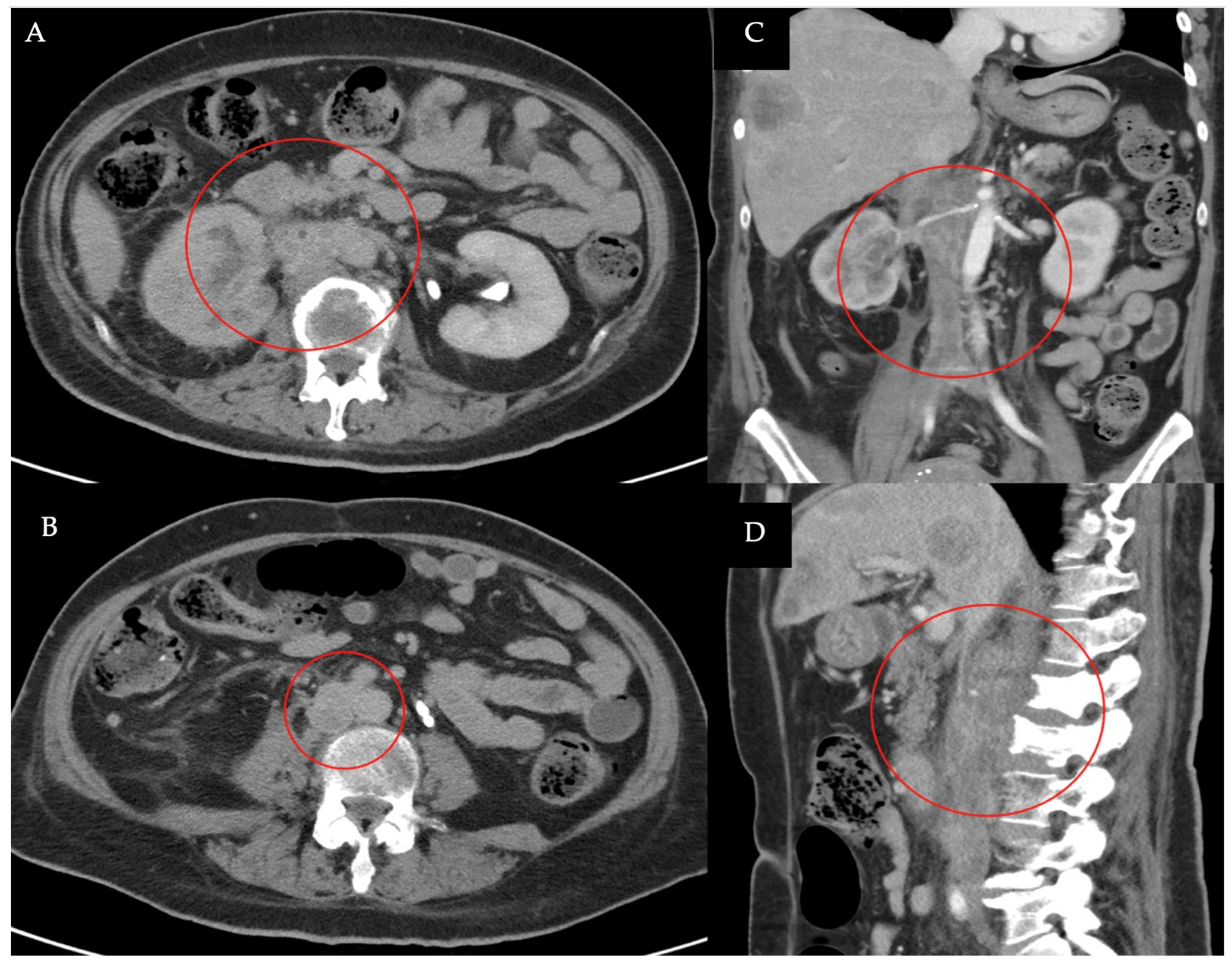 Medicina 60 01369 g001