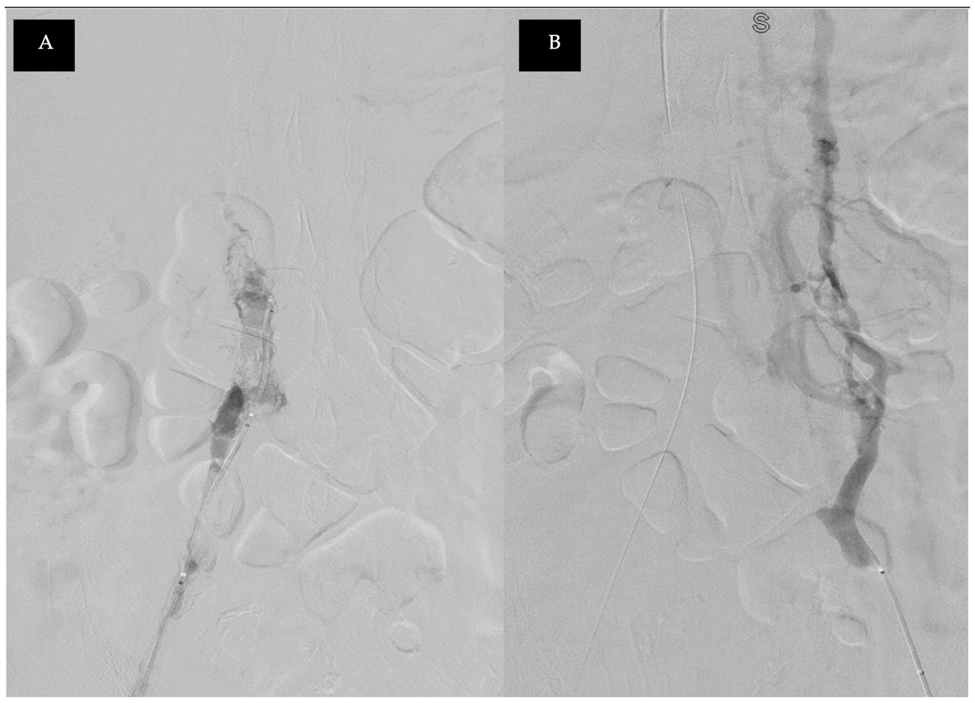 Medicina 60 01369 g002