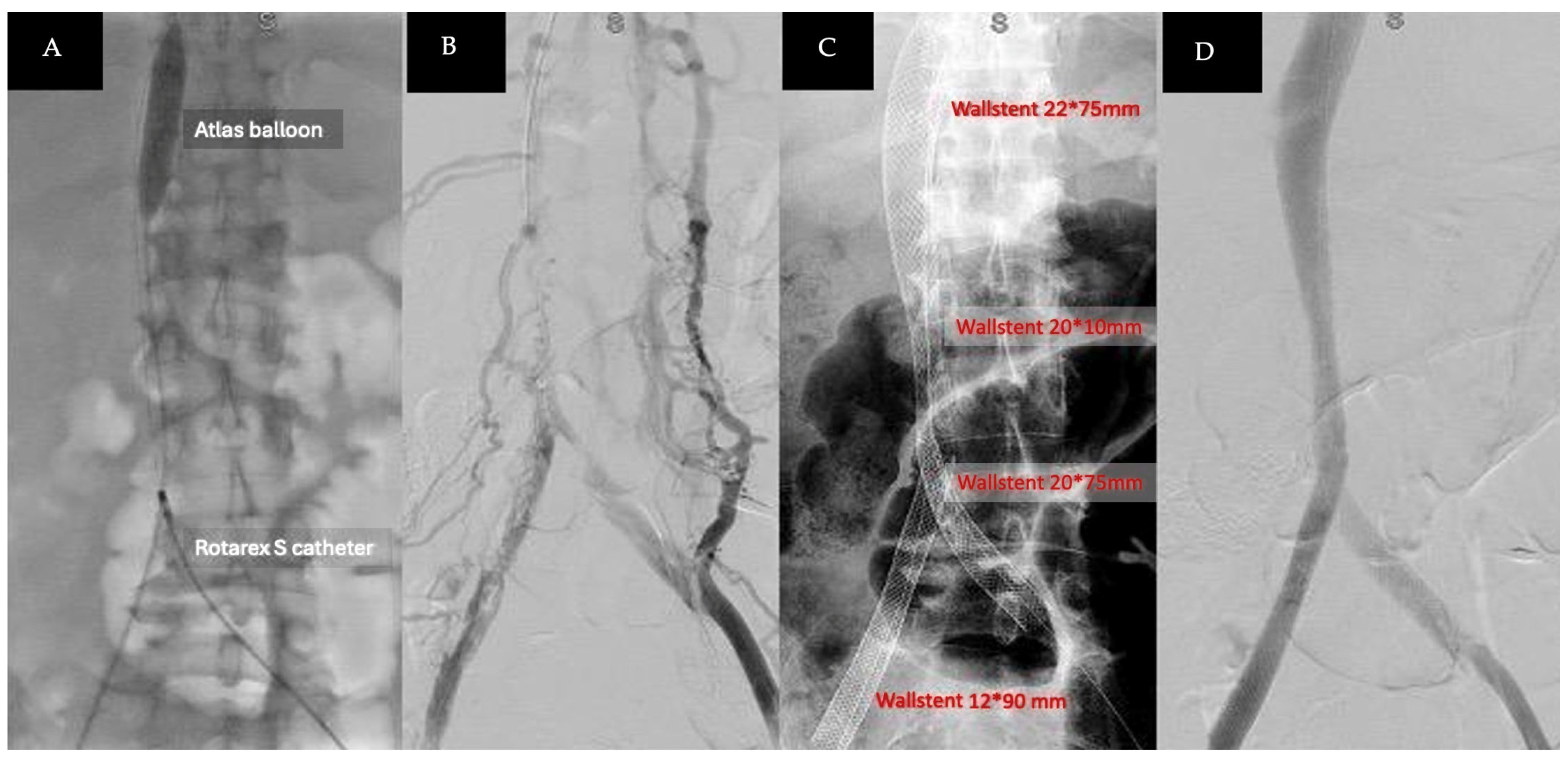 Medicina 60 01369 g003