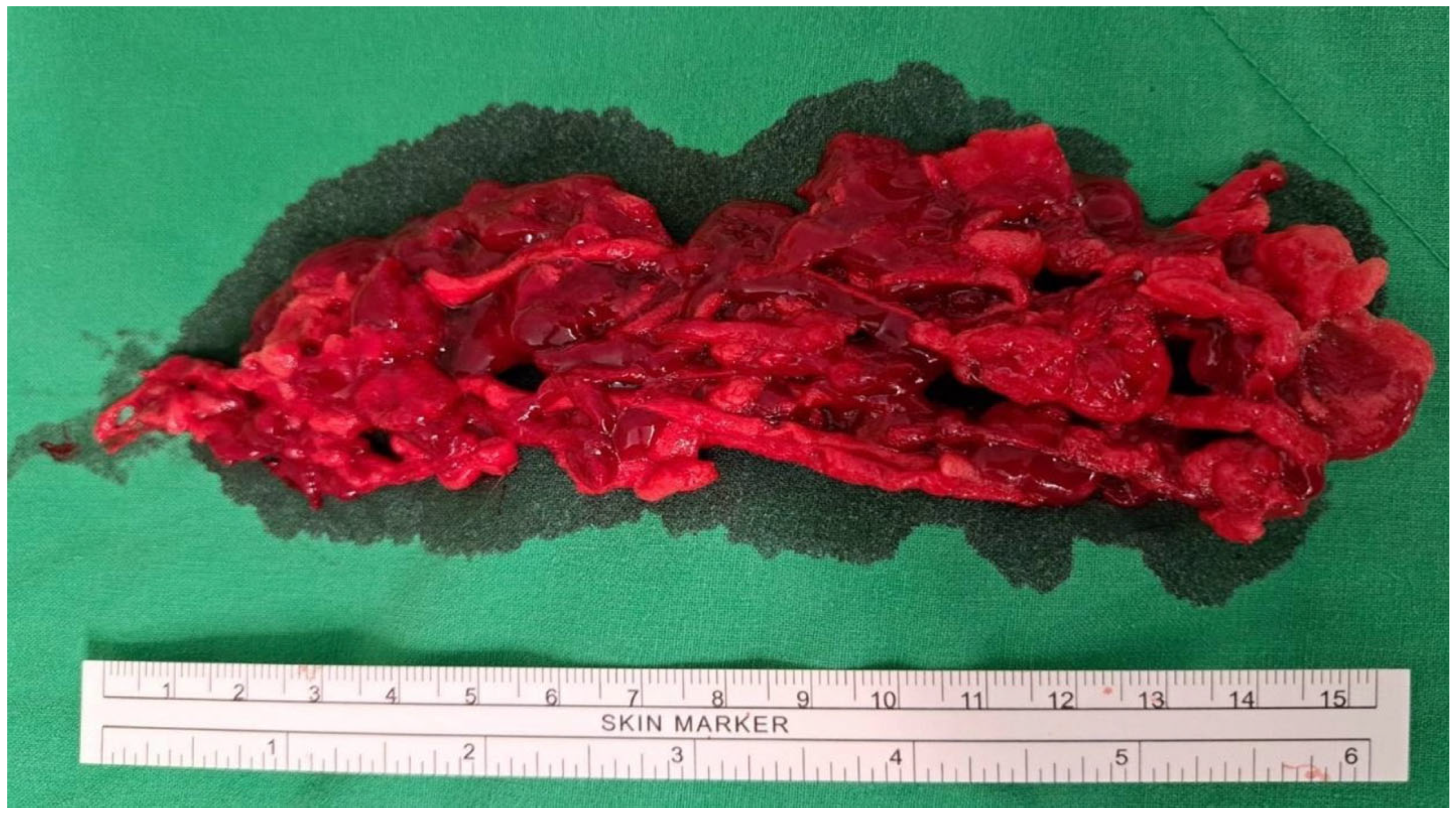 Medicina 60 01369 g004