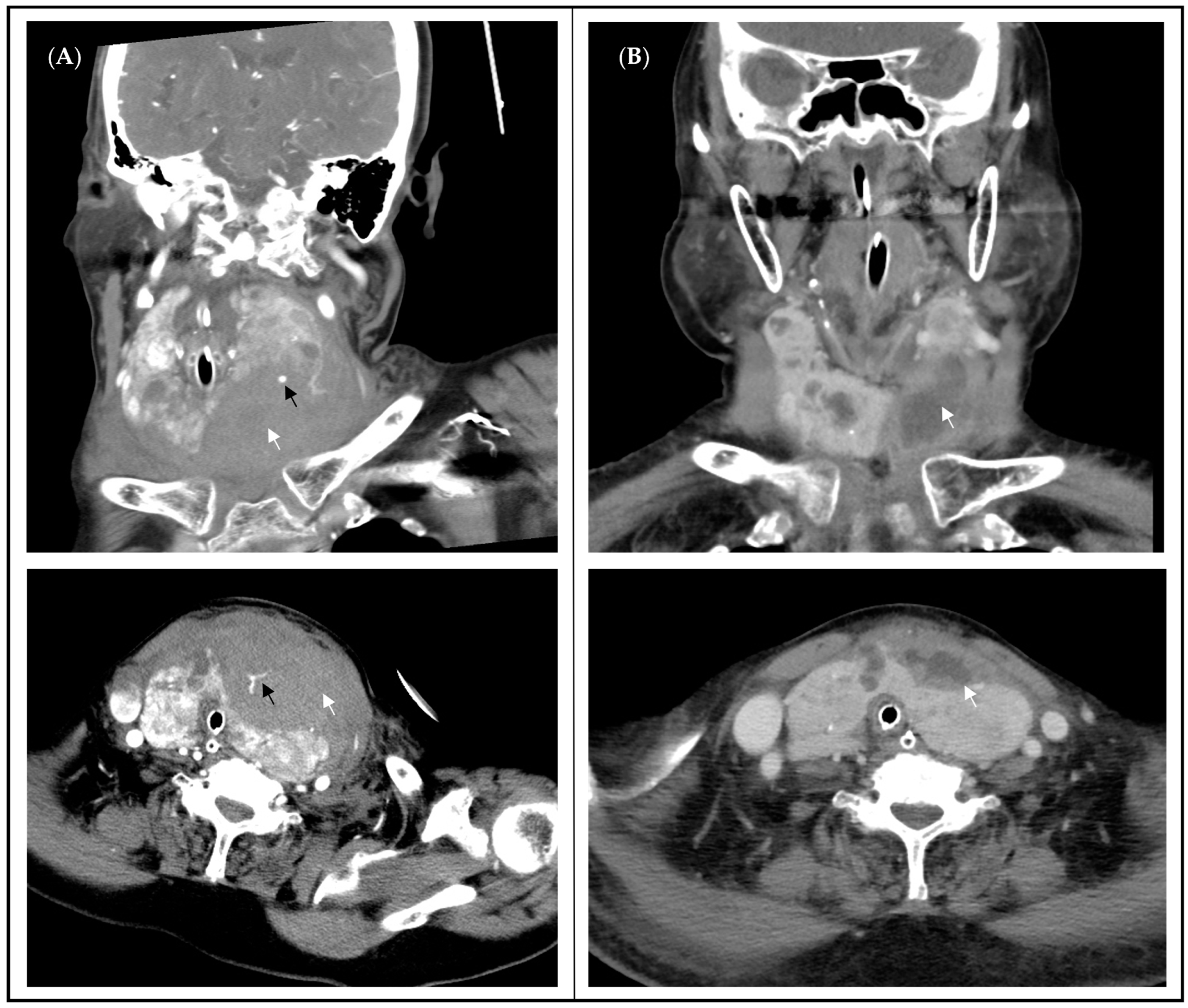 Medicina 60 01383 g001