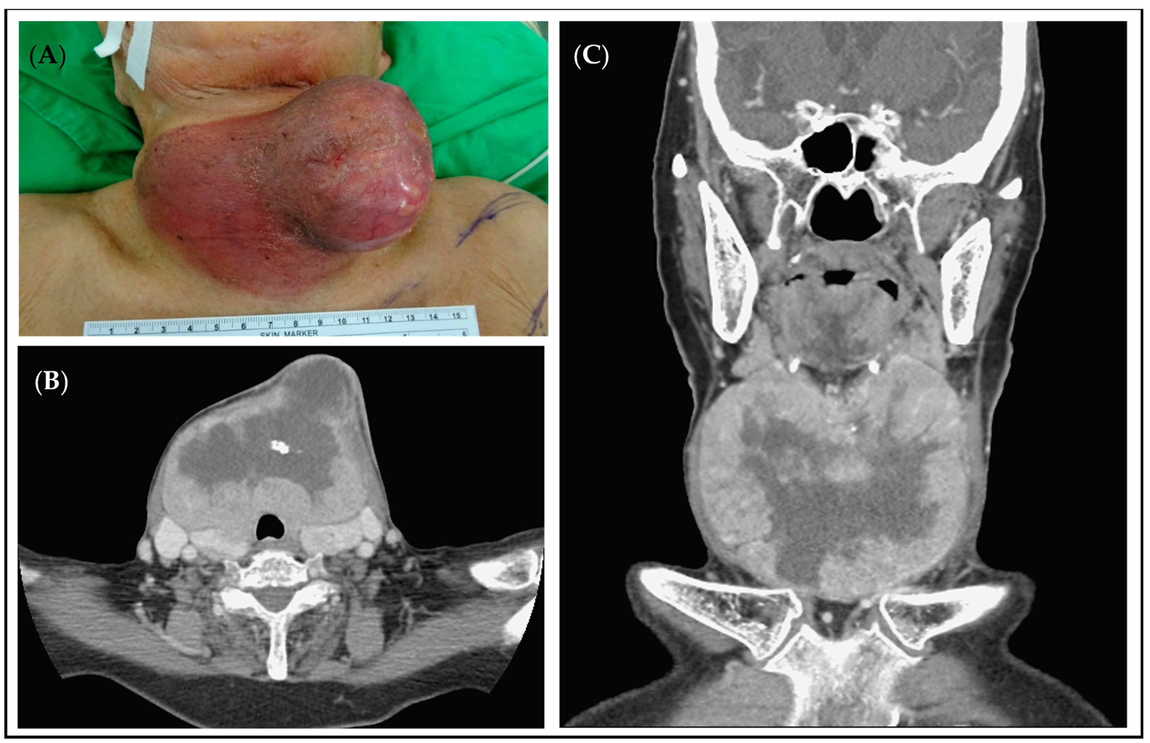 Medicina 60 01383 g002