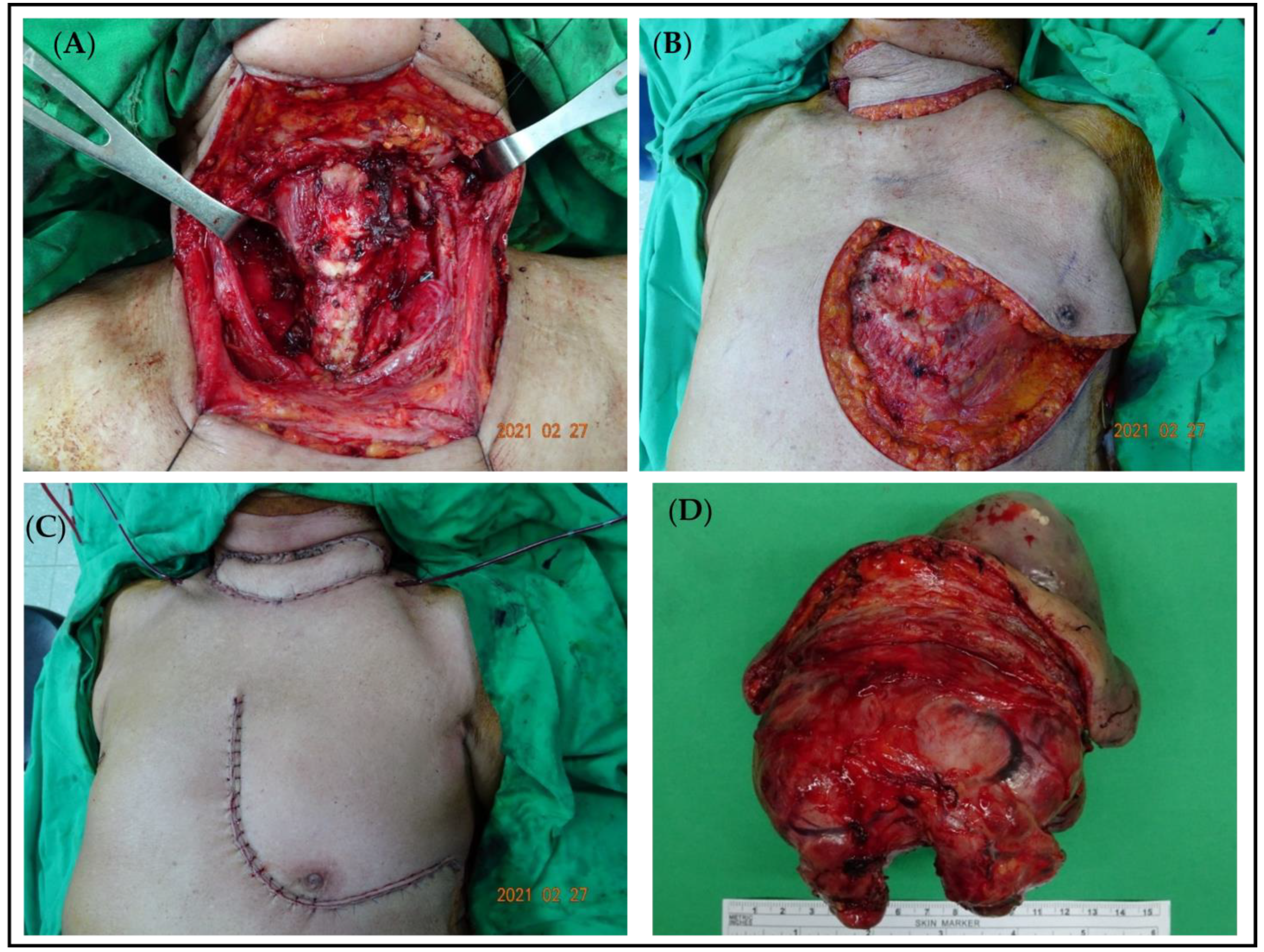 Medicina 60 01383 g003