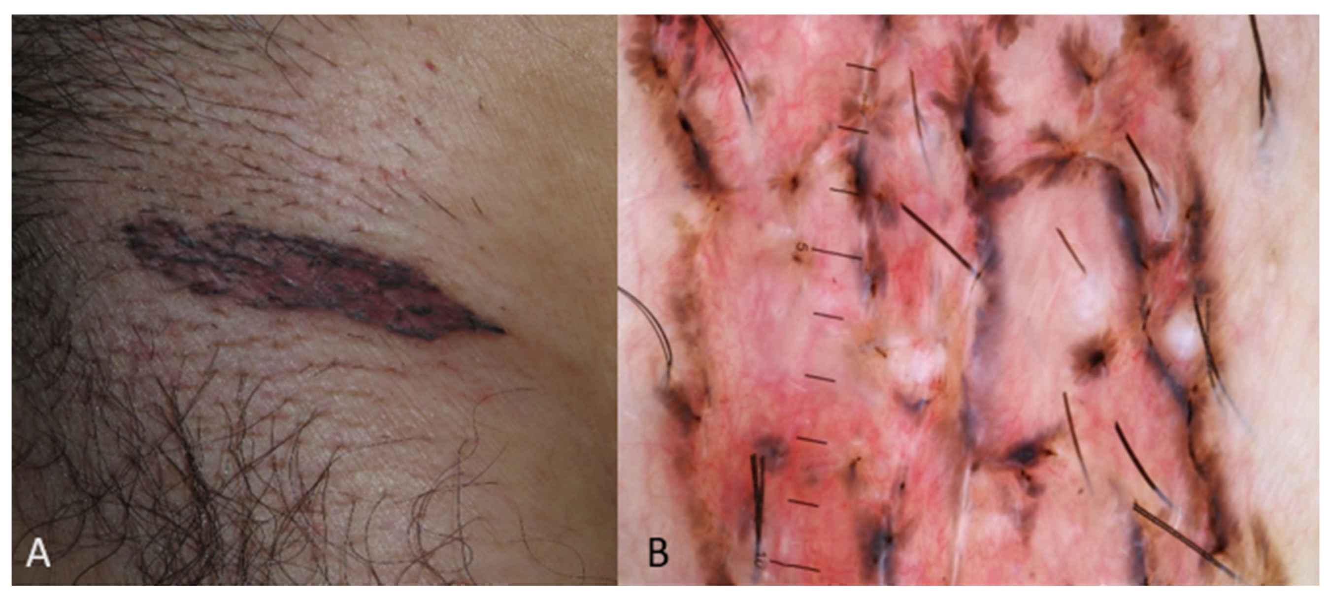 Medicina 60 01386 g001