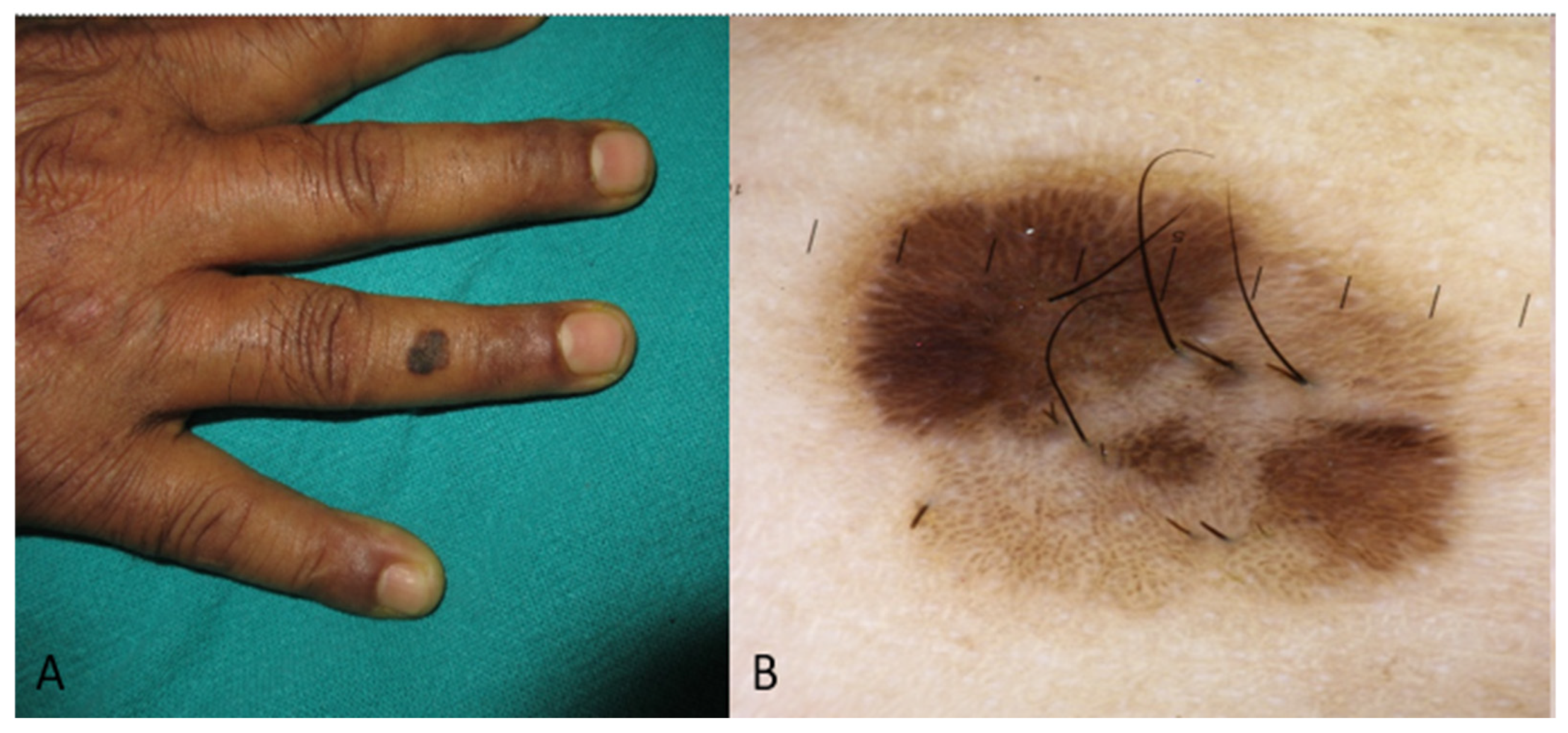 Medicina 60 01386 g002