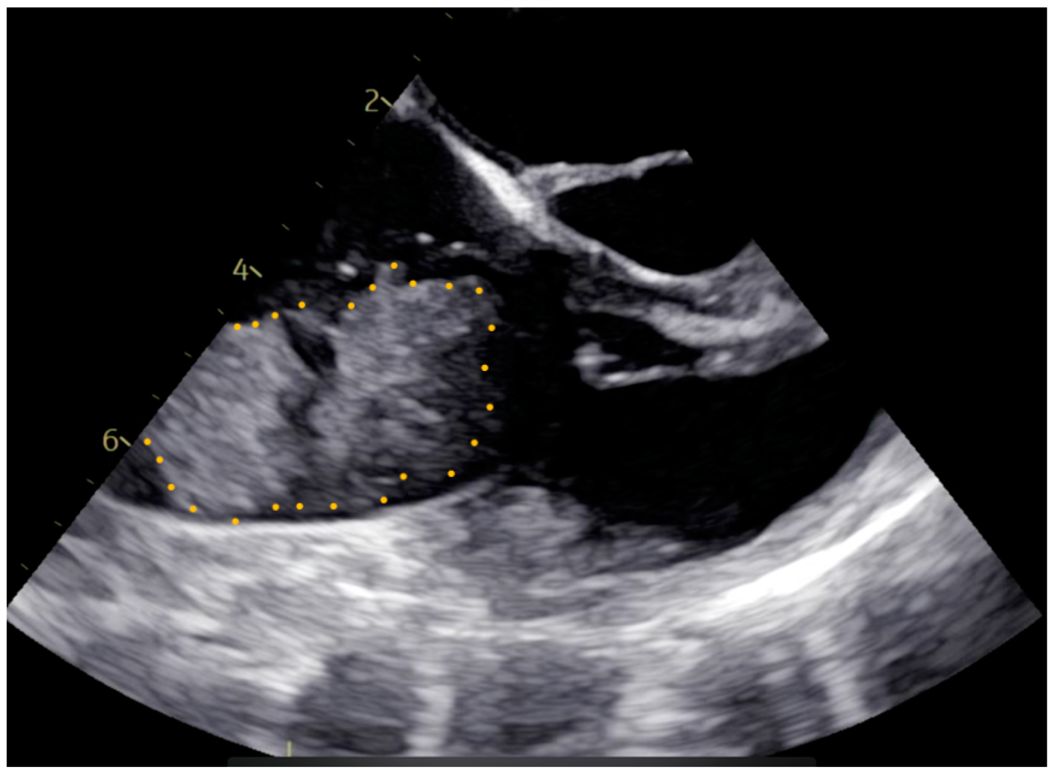 Medicina 60 01390 g001