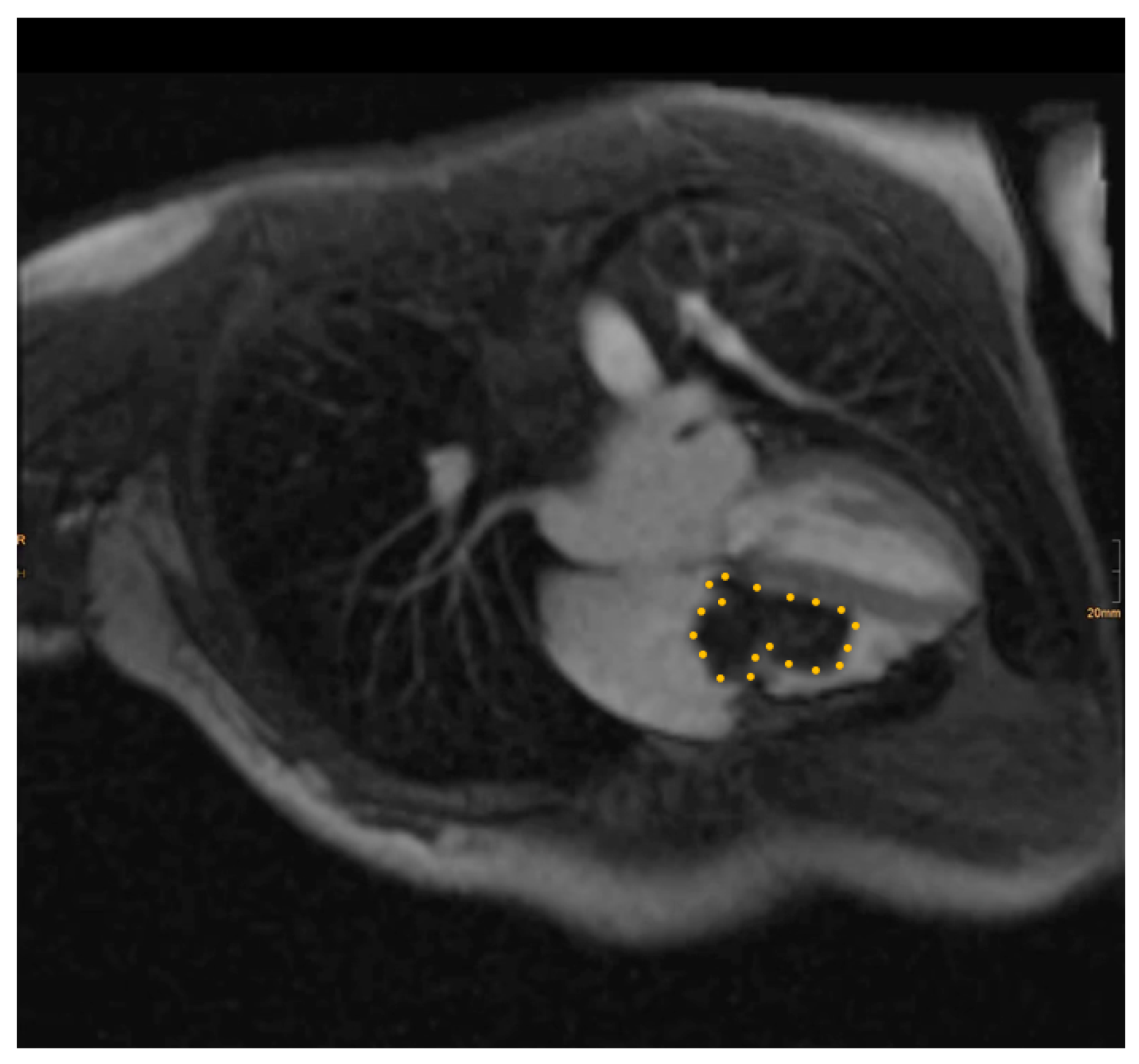 Medicina 60 01390 g002