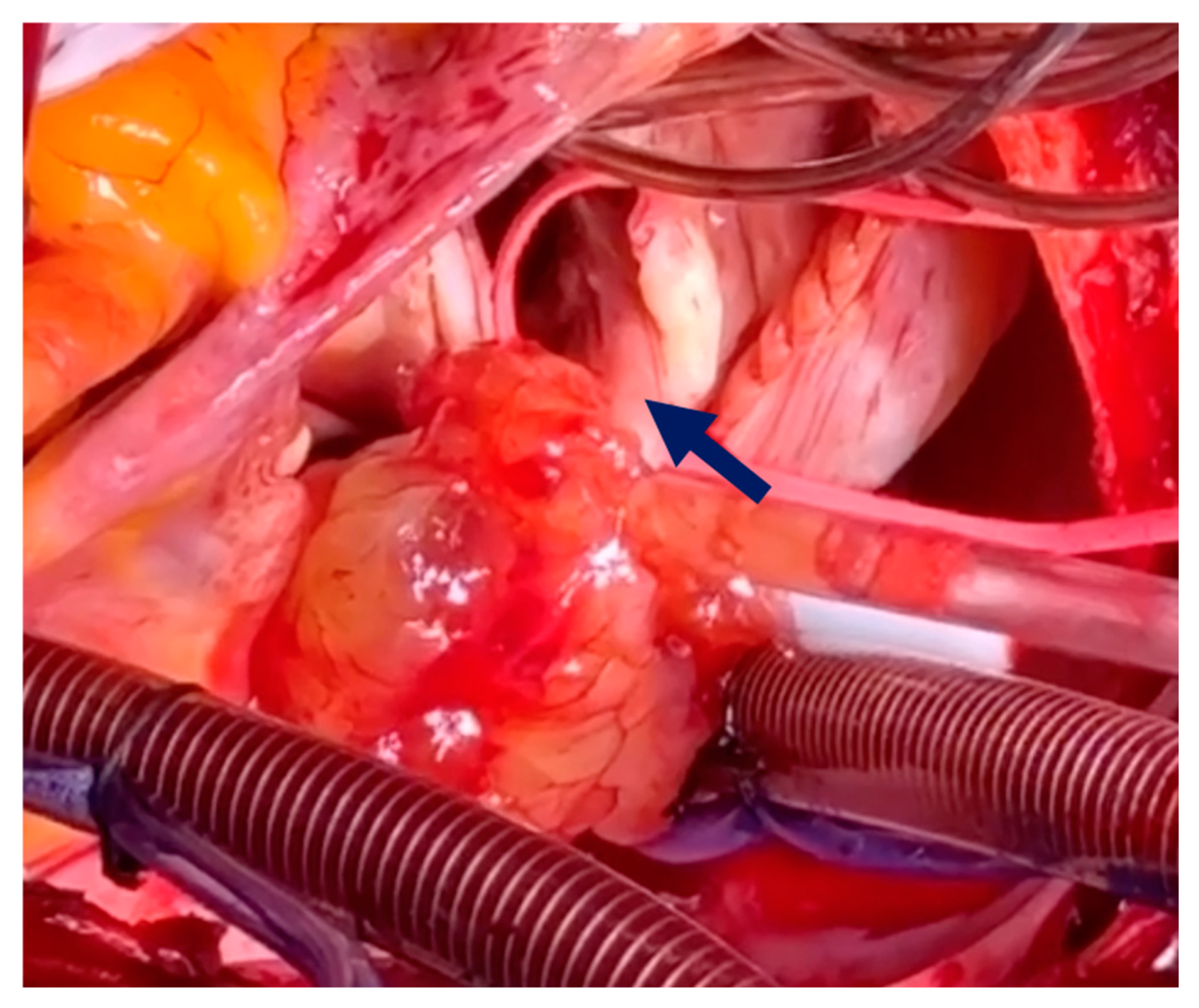 Medicina 60 01390 g003