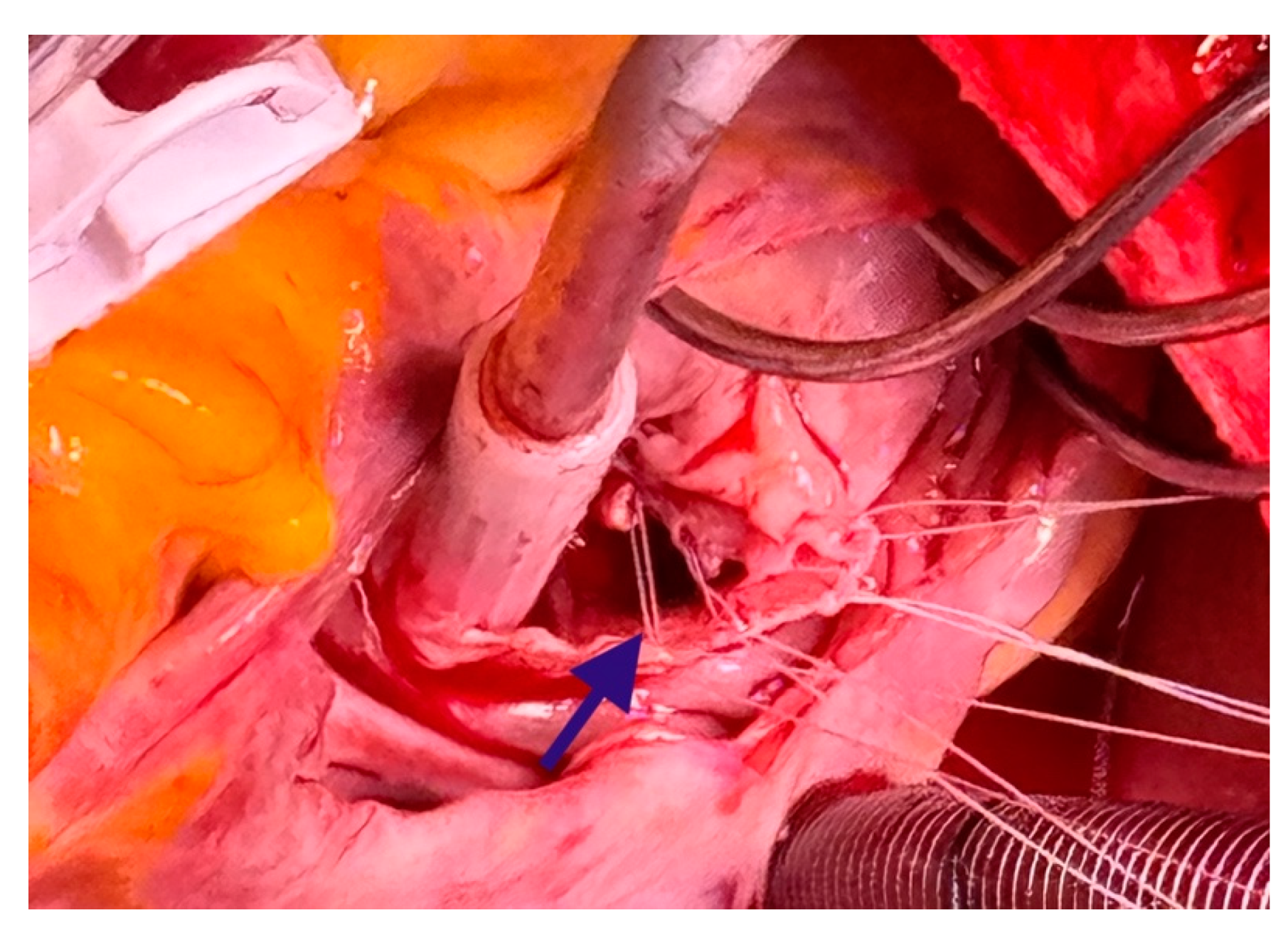 Medicina 60 01390 g005