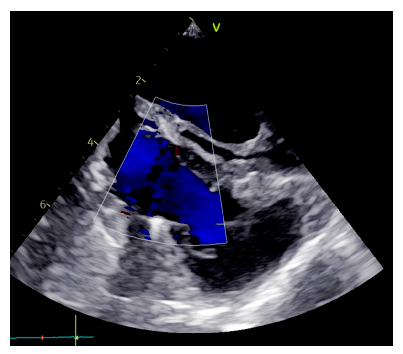 Medicina 60 01390 g006