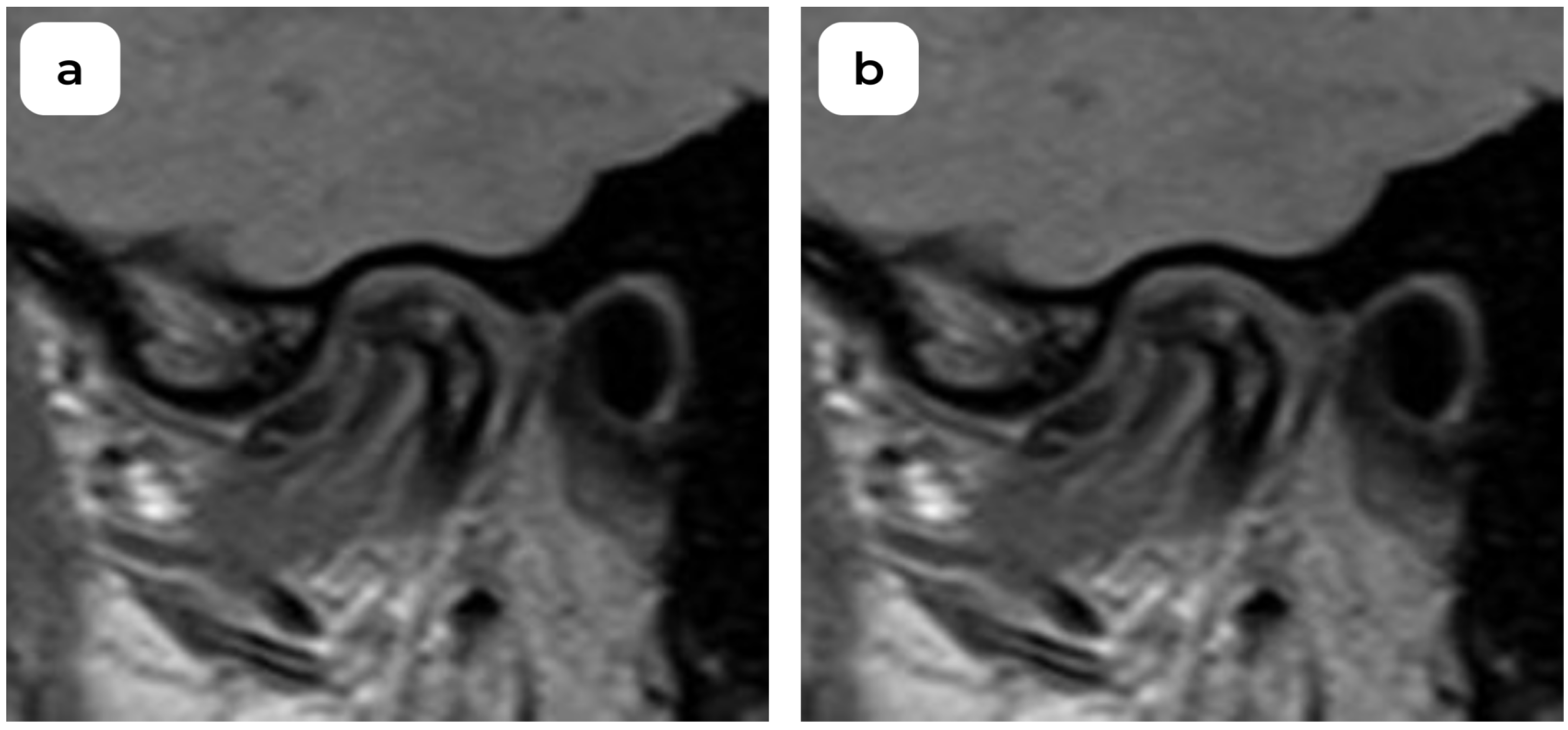 Medicina 60 01396 g001