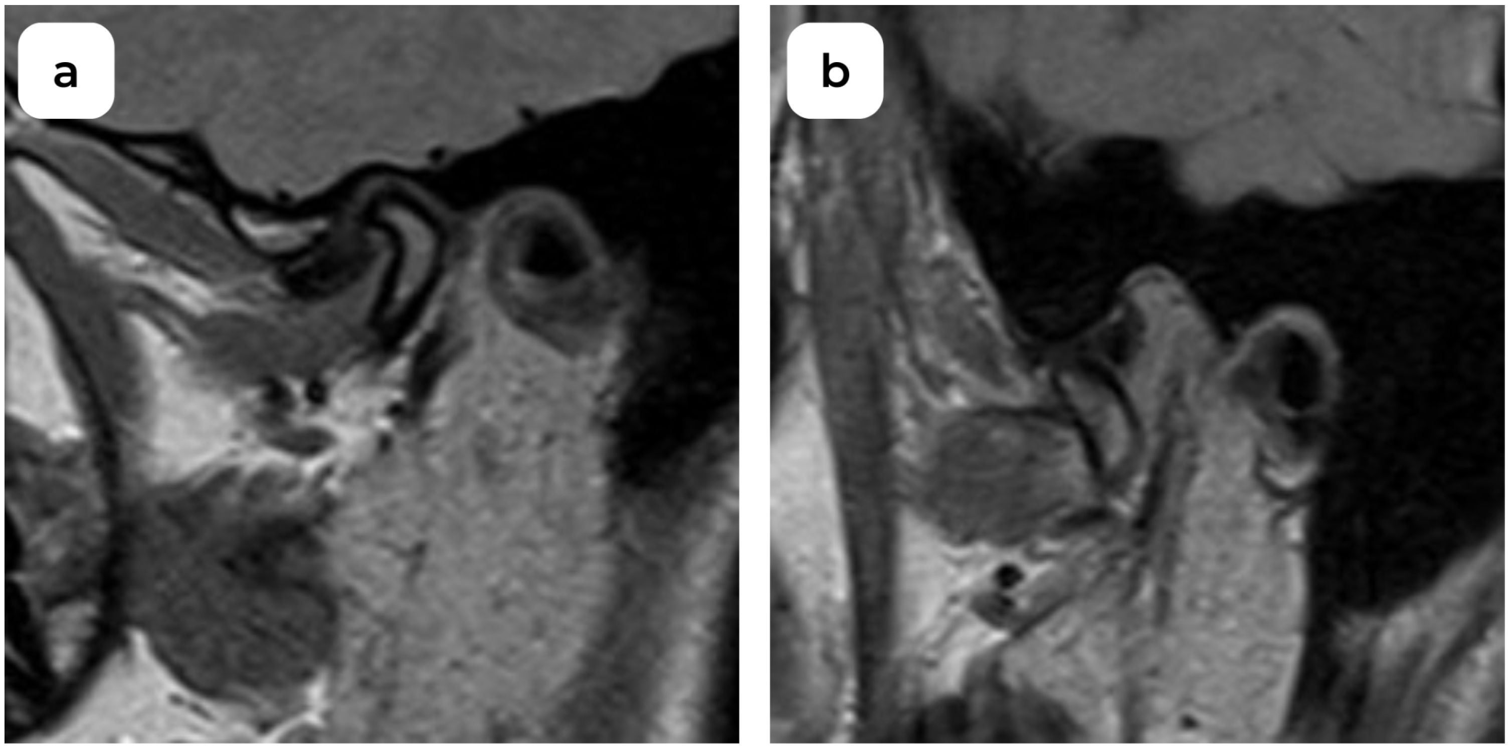 Medicina 60 01396 g002