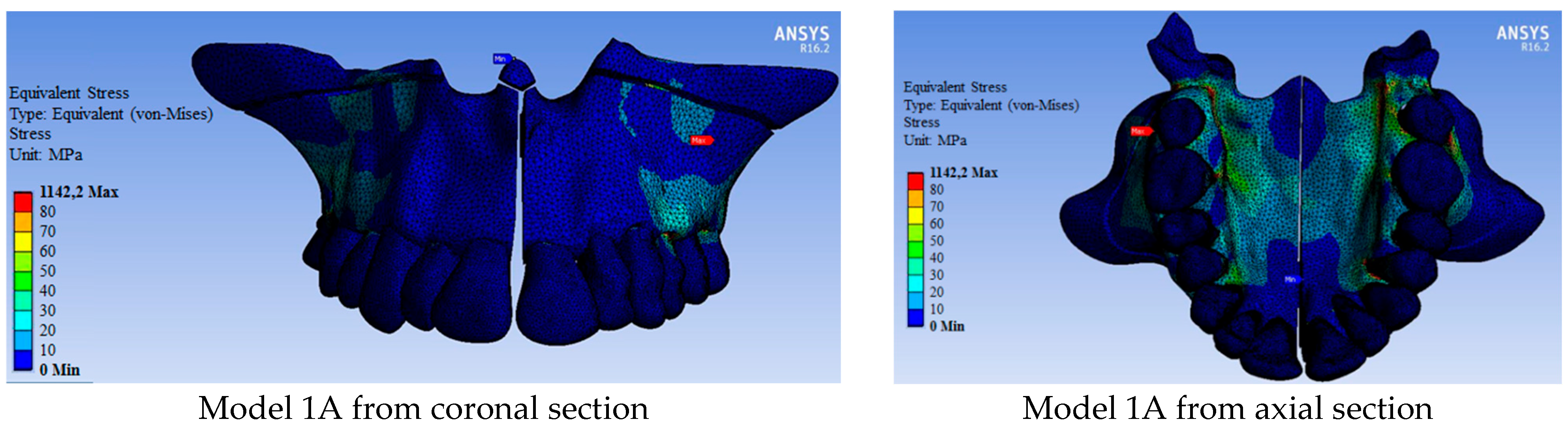 Medicina 60 01400 g004a Medicina 60 01400 g004a