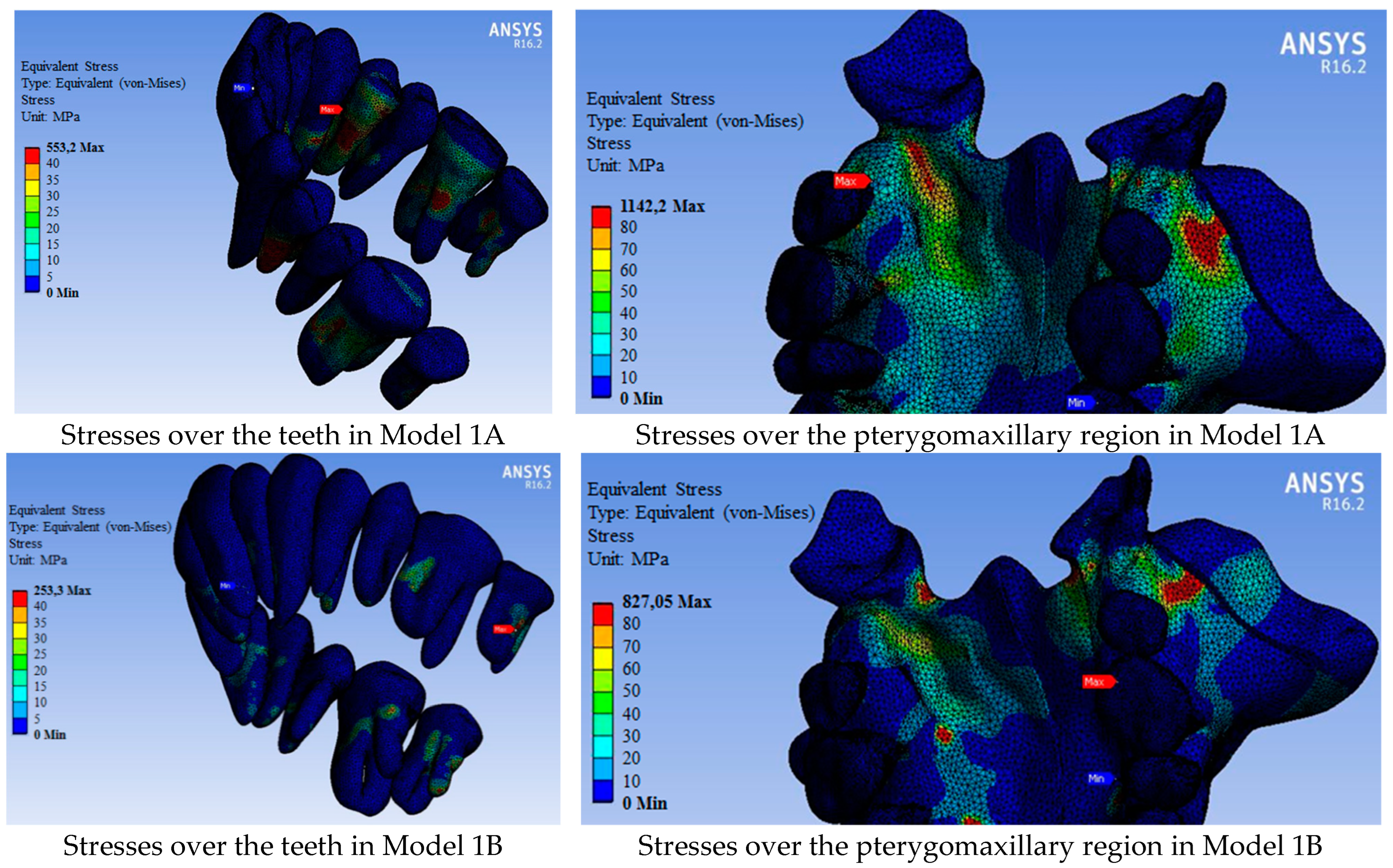 Medicina 60 01400 g005a Medicina 60 01400 g005a