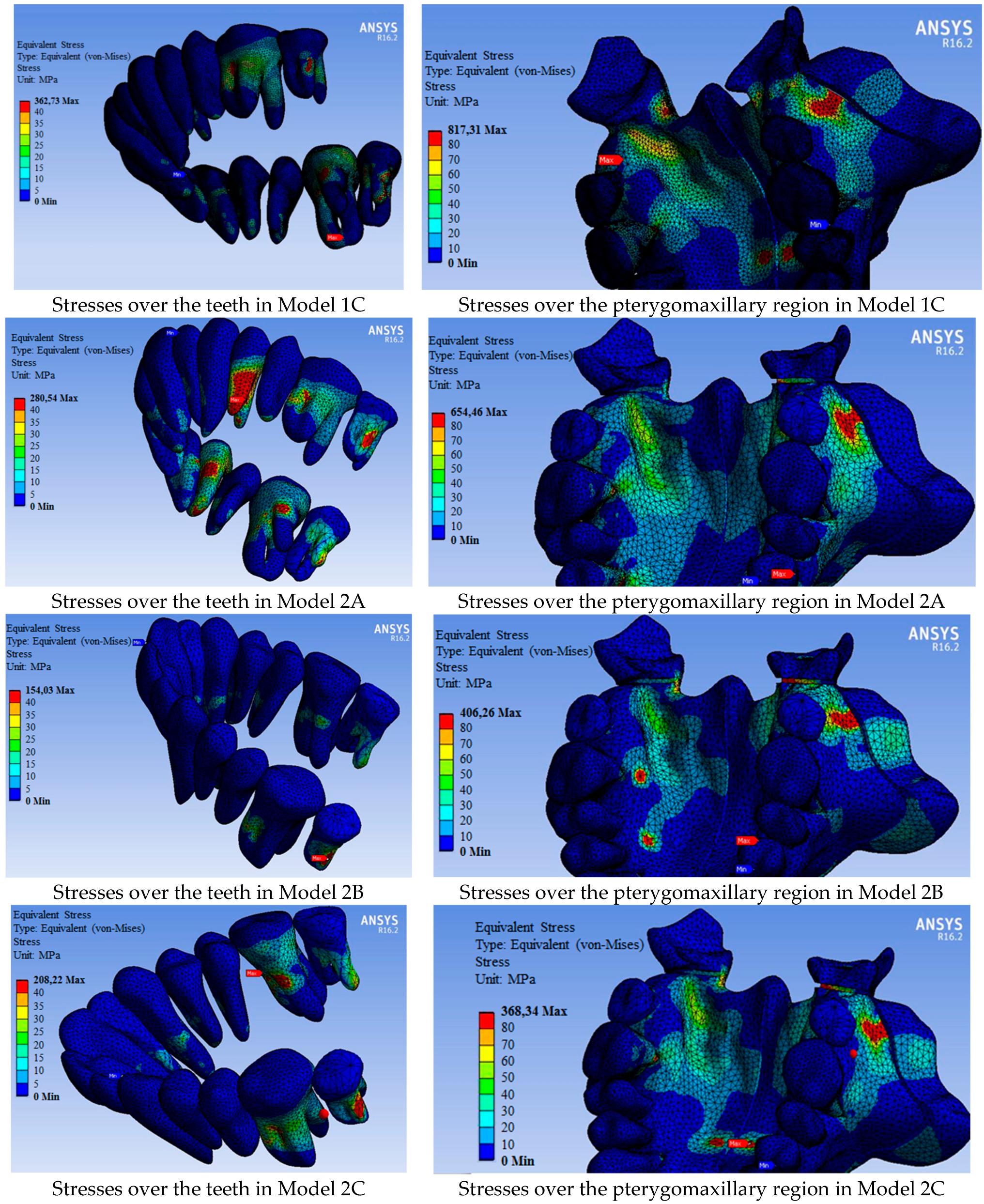 Medicina 60 01400 g005b Medicina 60 01400 g005b