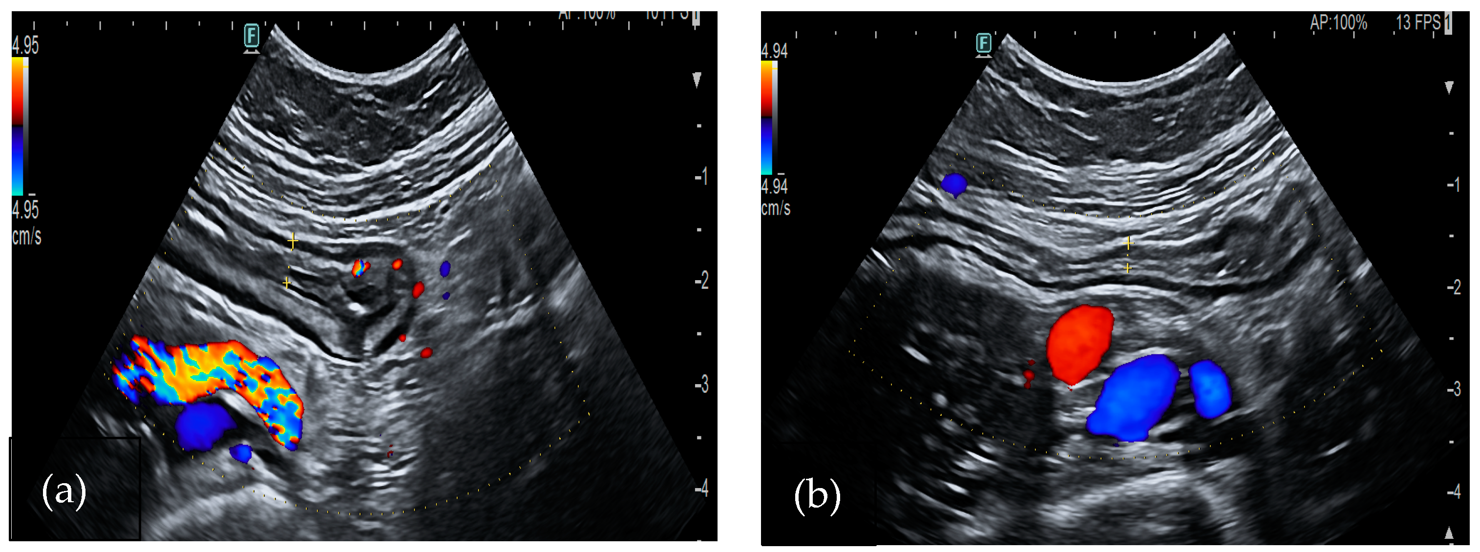 Medicina 60 01402 g002