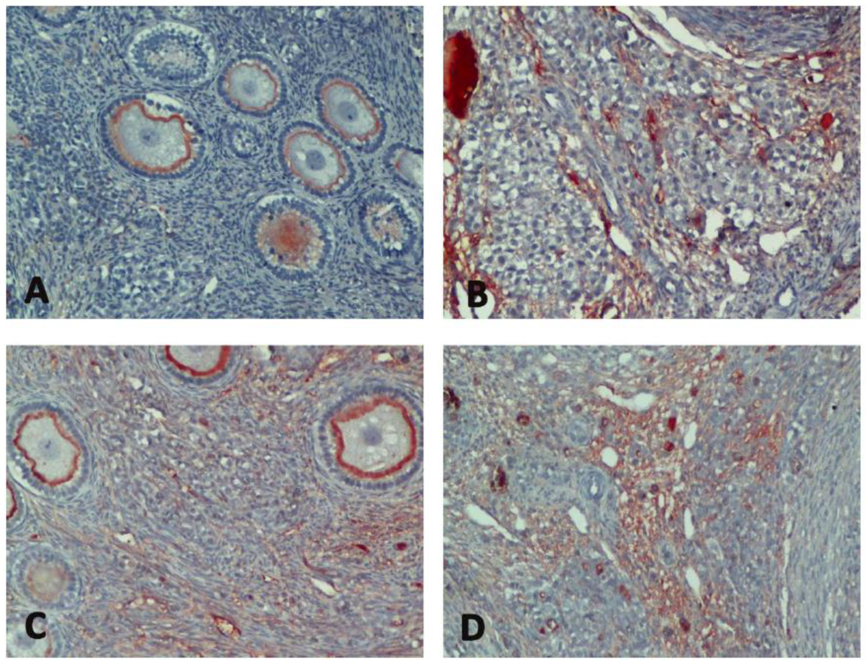 Medicina 60 01403 g004