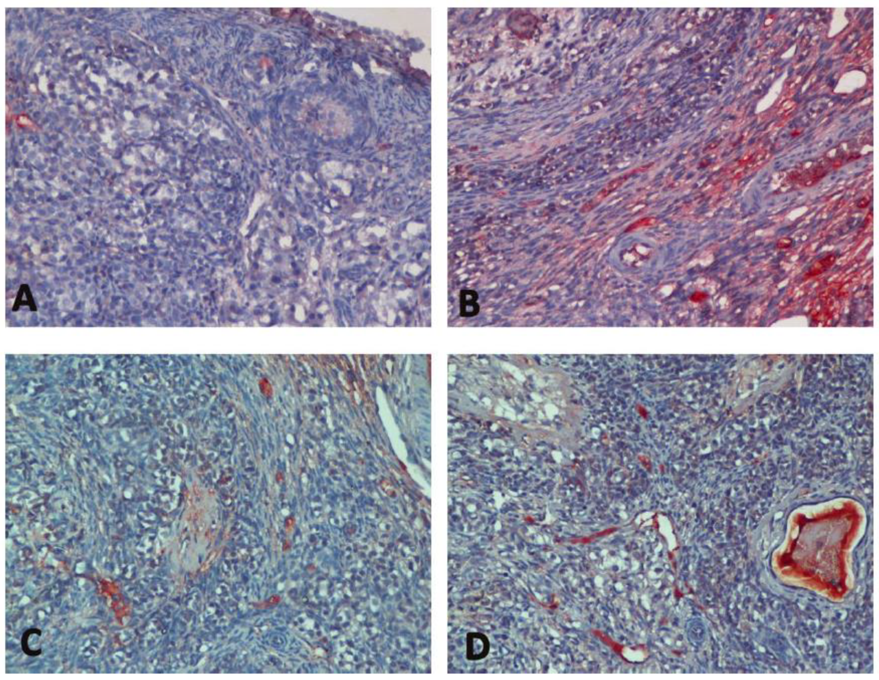 Medicina 60 01403 g005