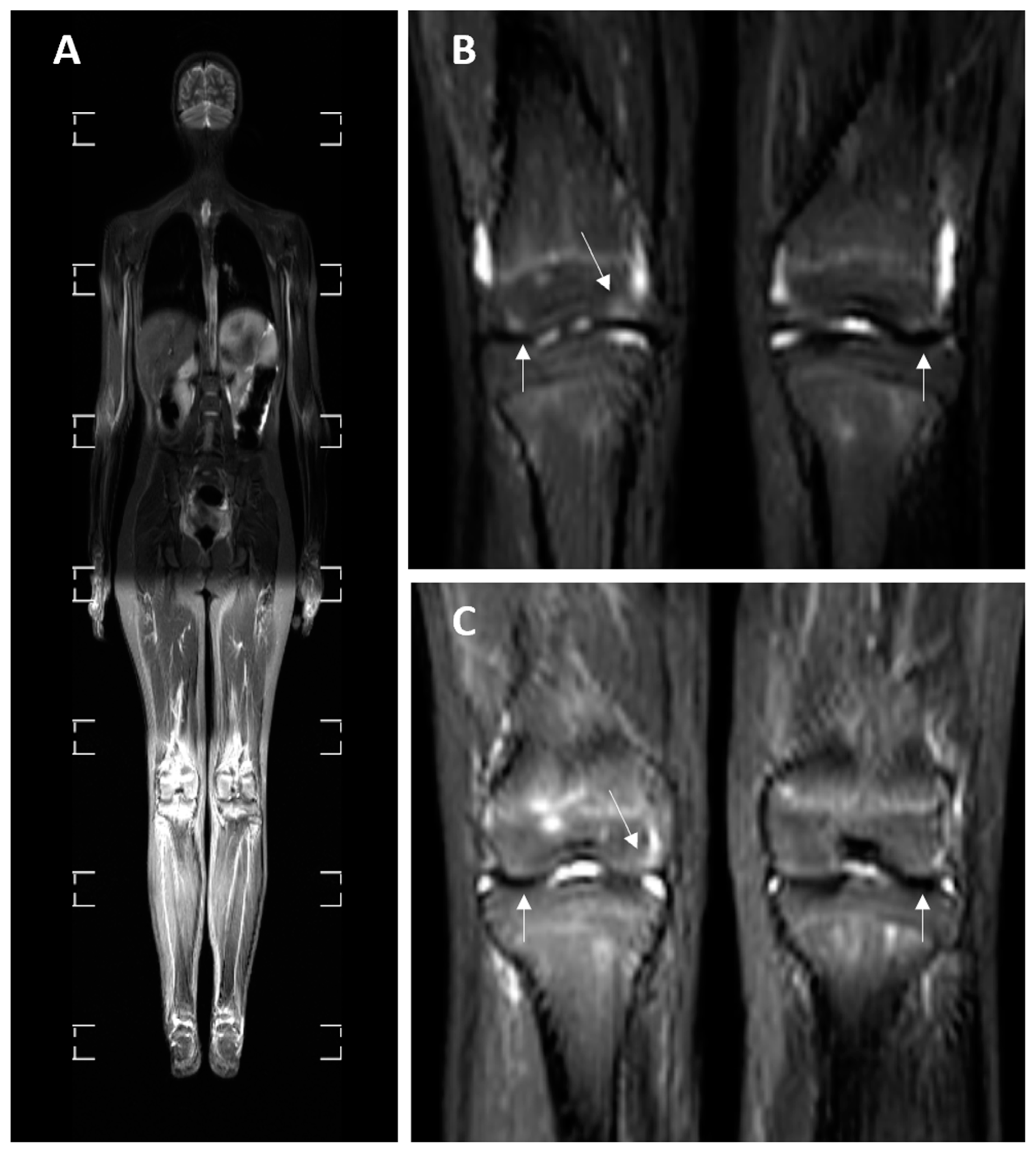 Medicina 60 01407 g003