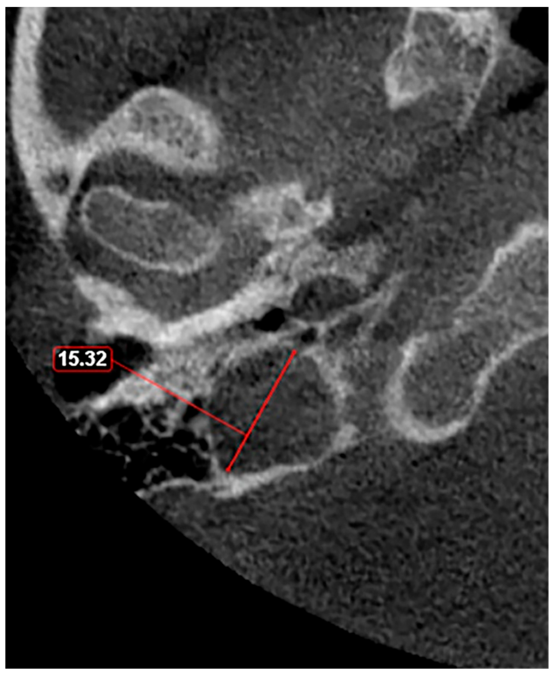 Medicina 60 01408 g004