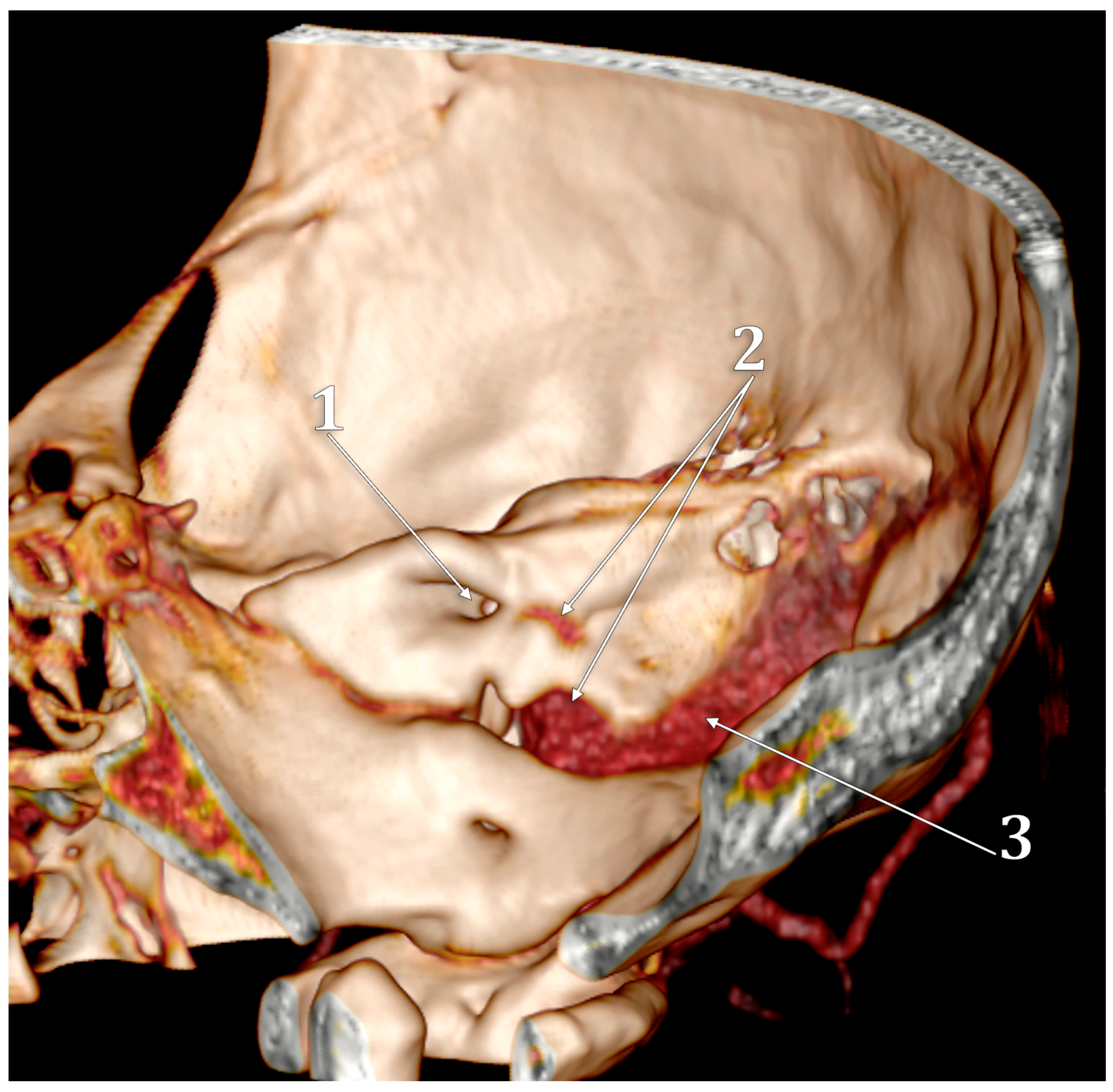 Medicina 60 01408 g005