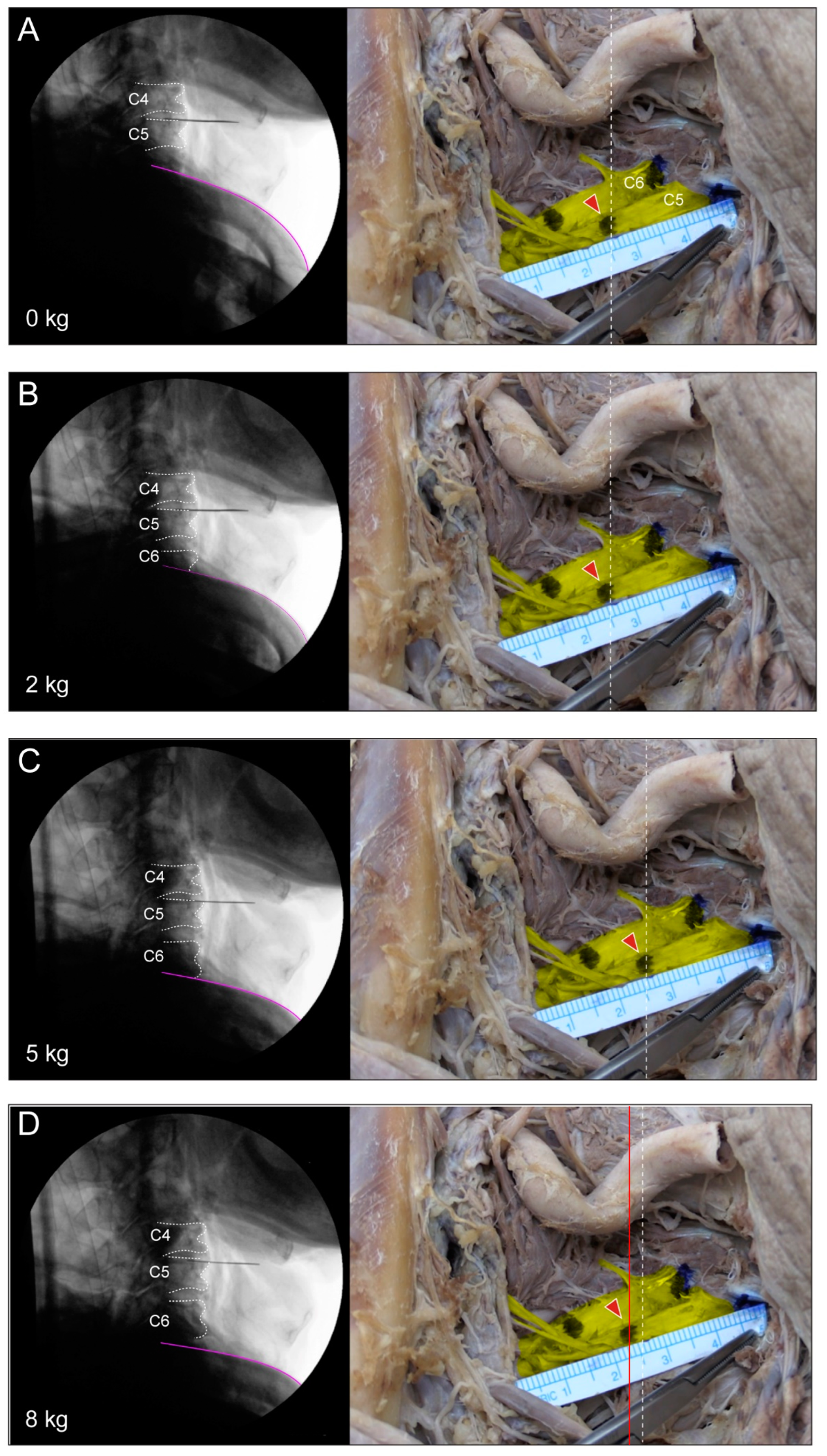Medicina 60 01429 g004a