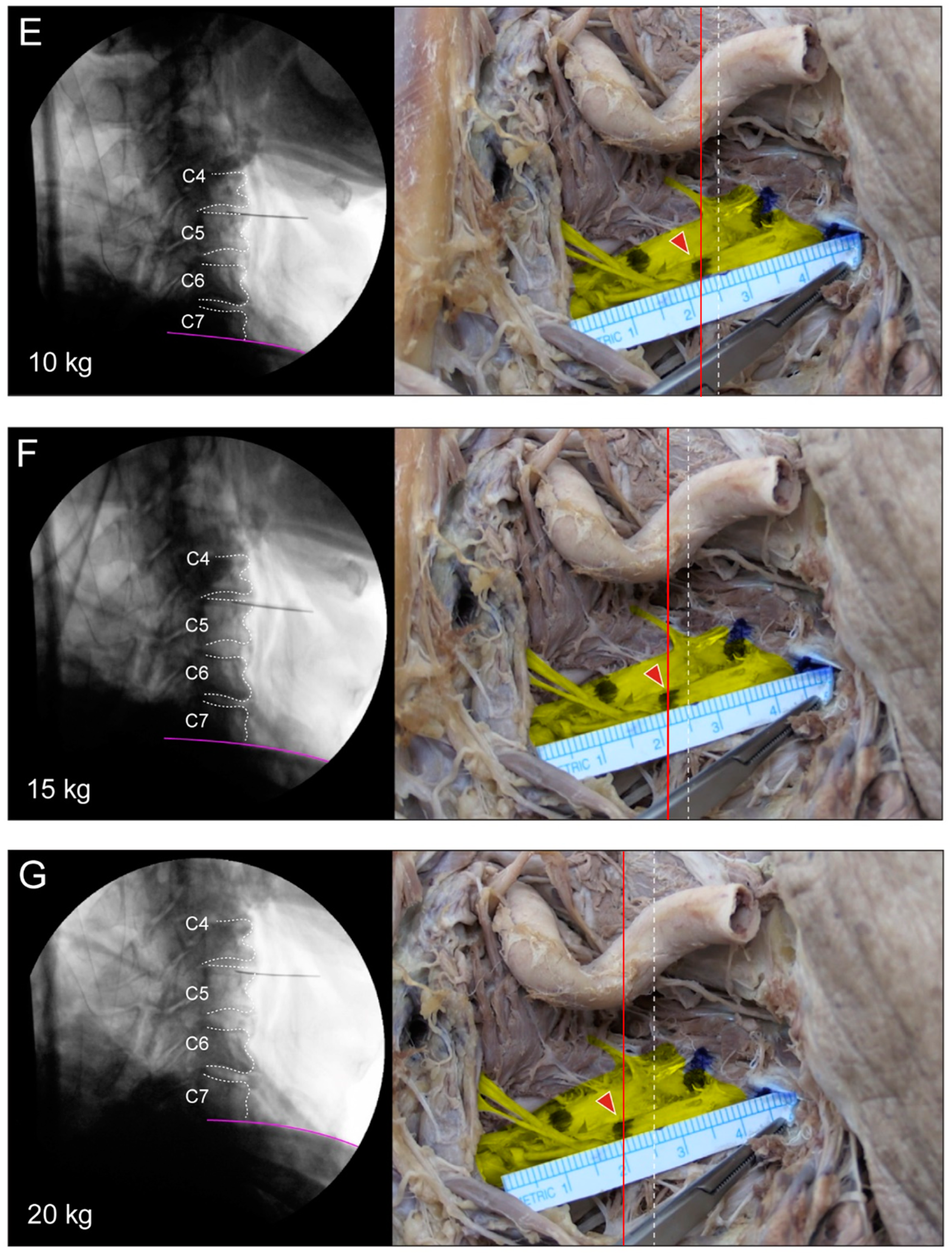 Medicina 60 01429 g004b