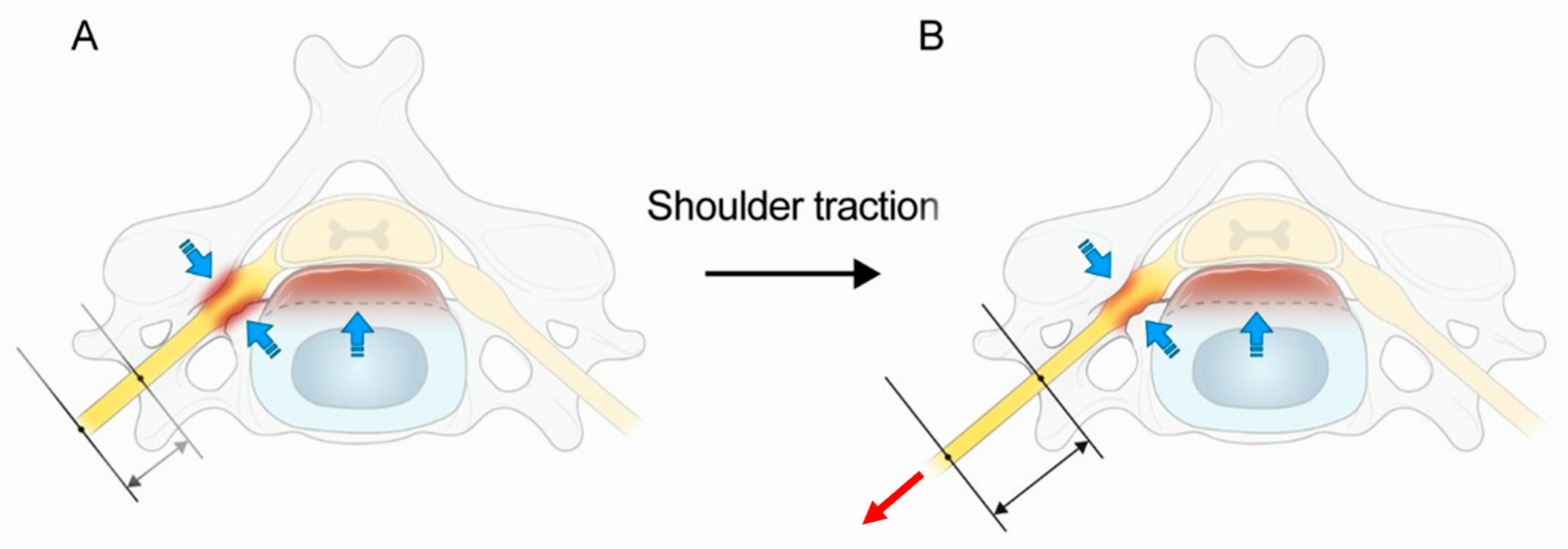 Medicina 60 01429 g005