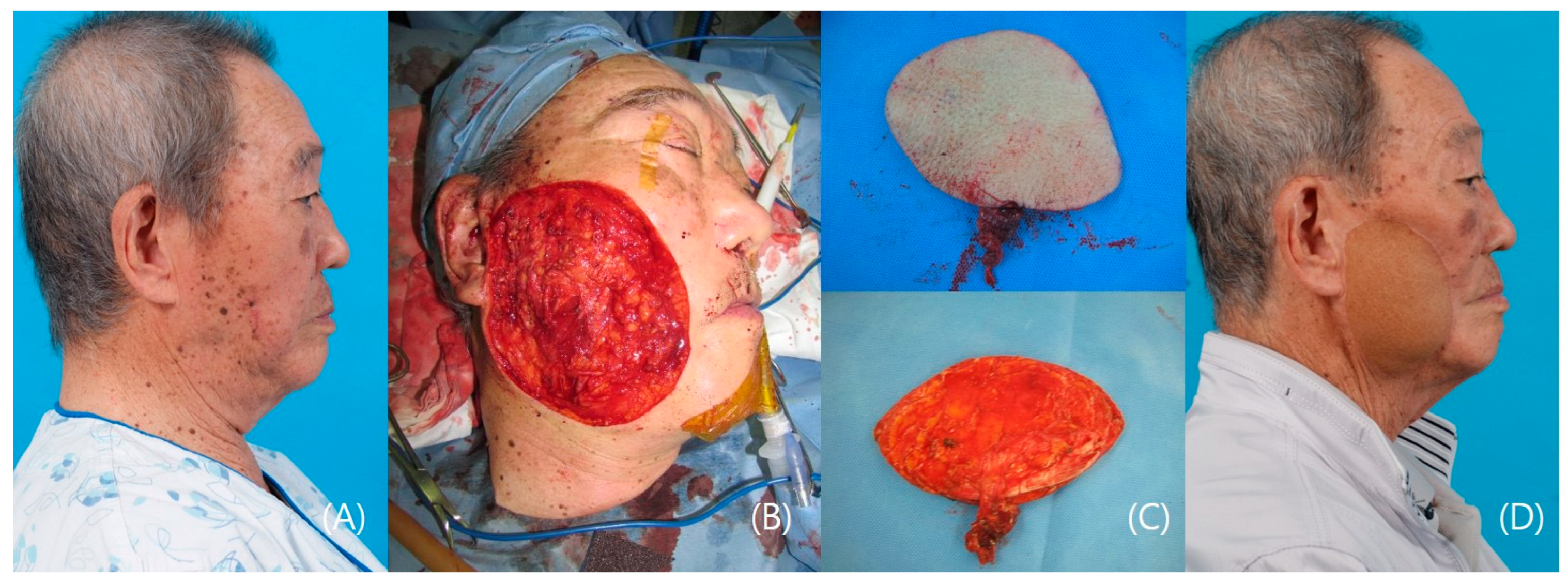 Medicina 60 01432 g003