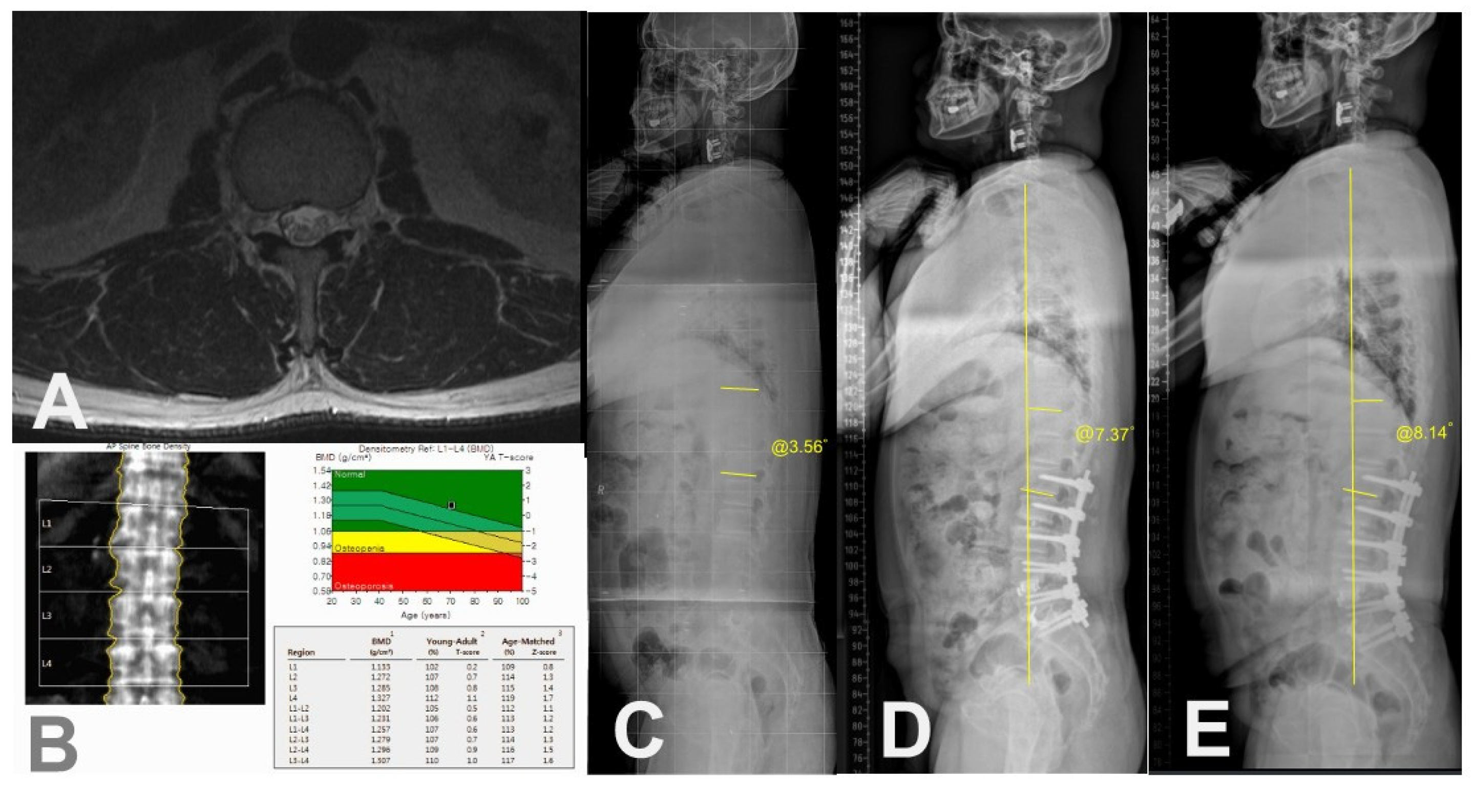 Medicina 60 01441 g005