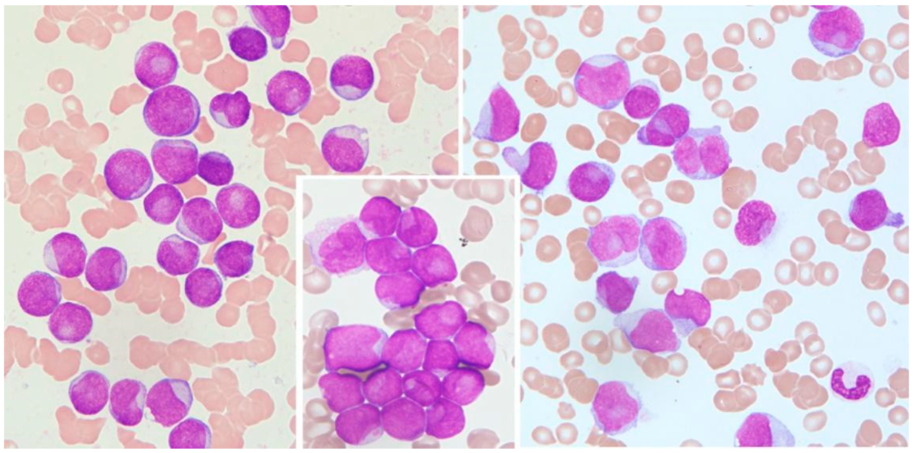 Medicina 60 01443 g001