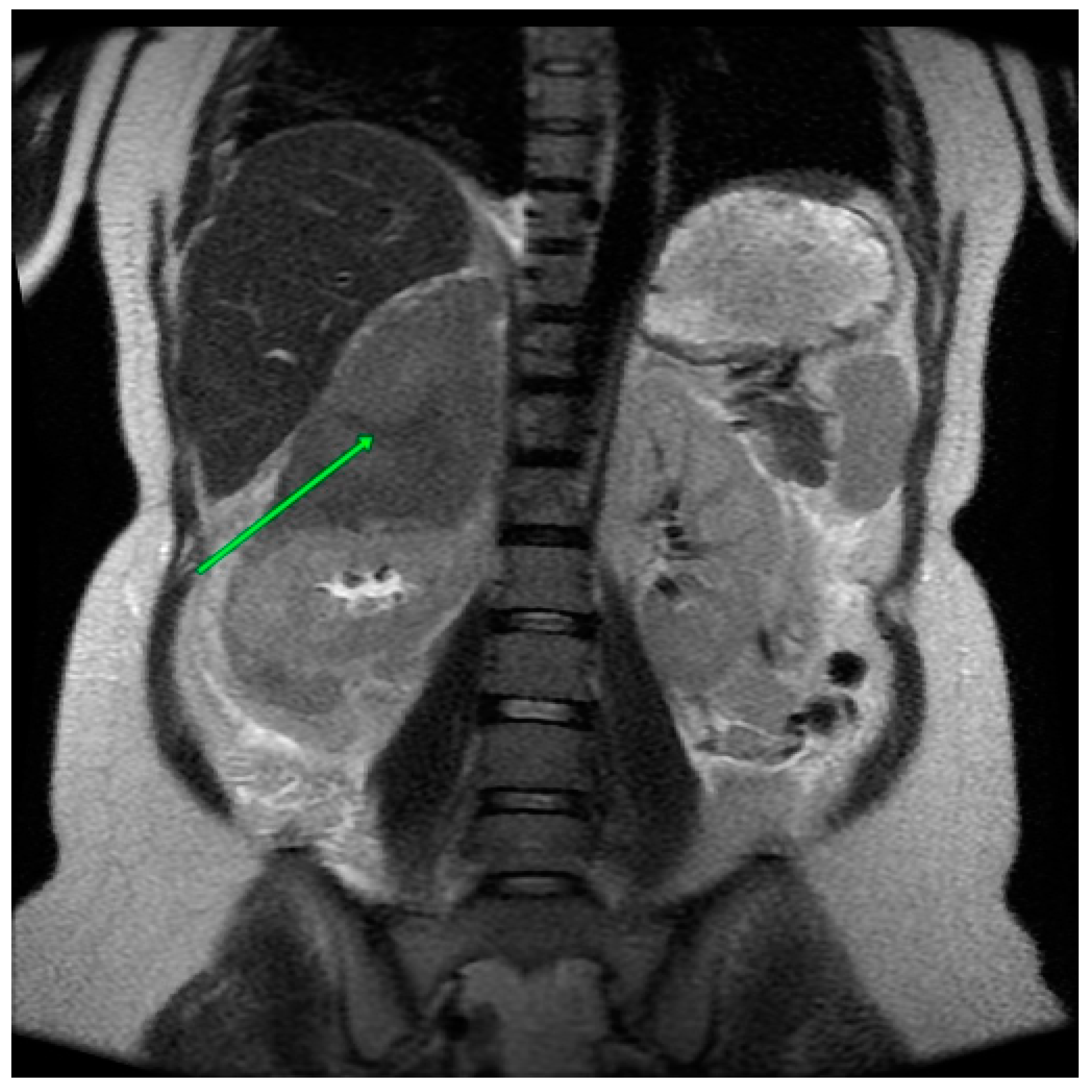 Medicina 60 01448 g001