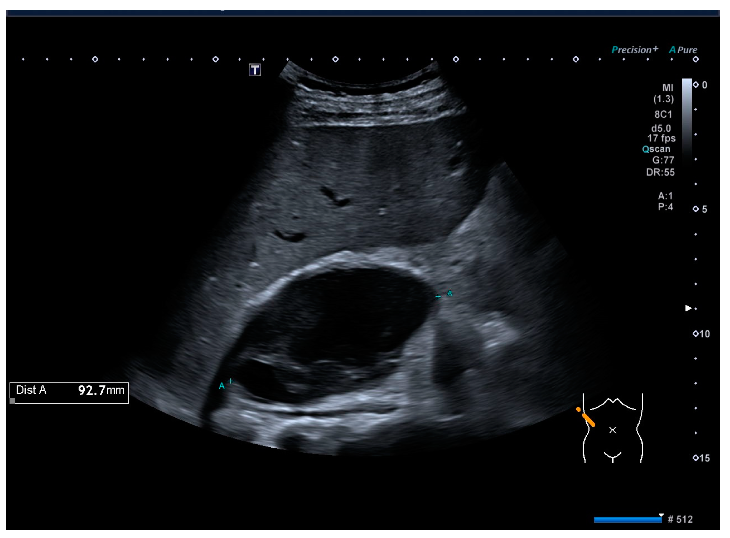 Medicina 60 01448 g002