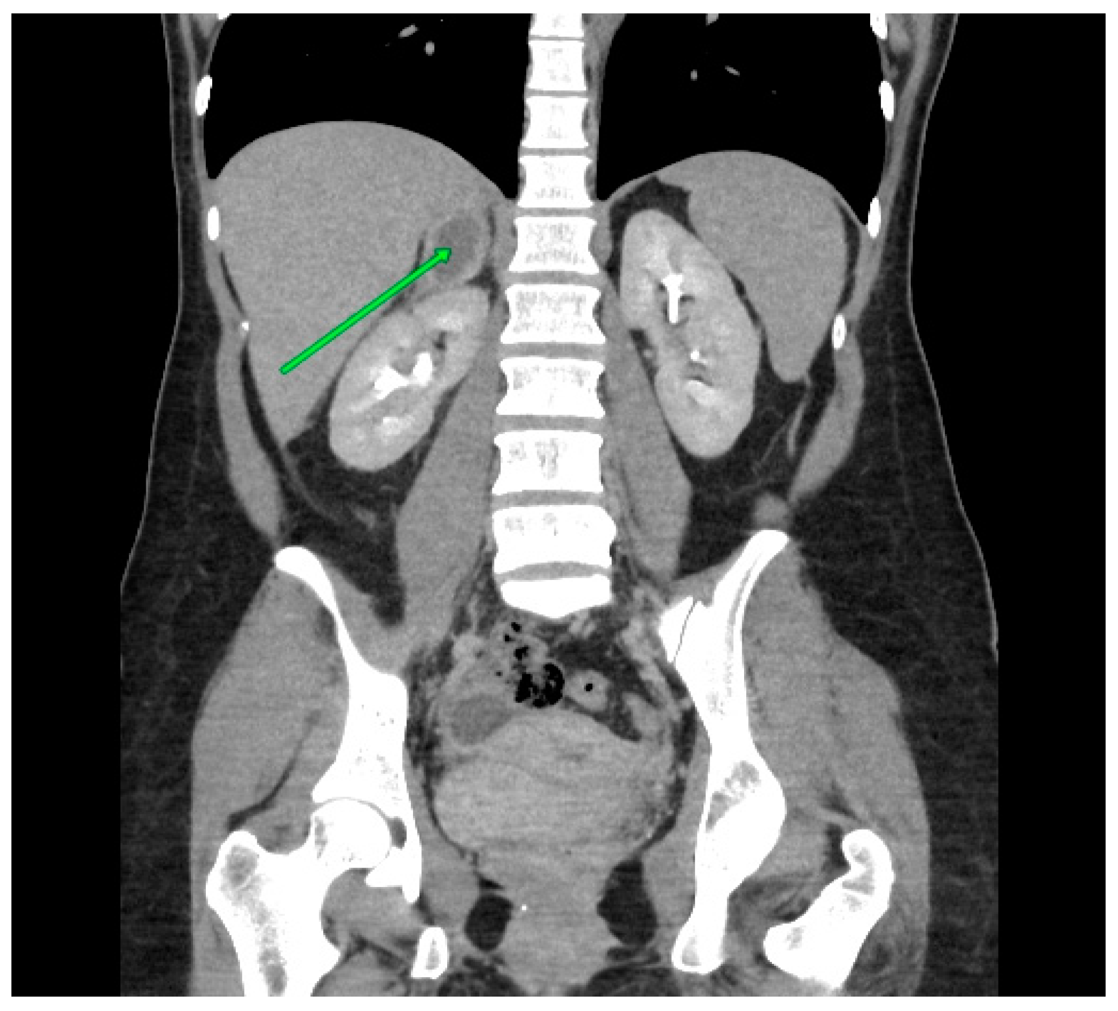 Medicina 60 01448 g003