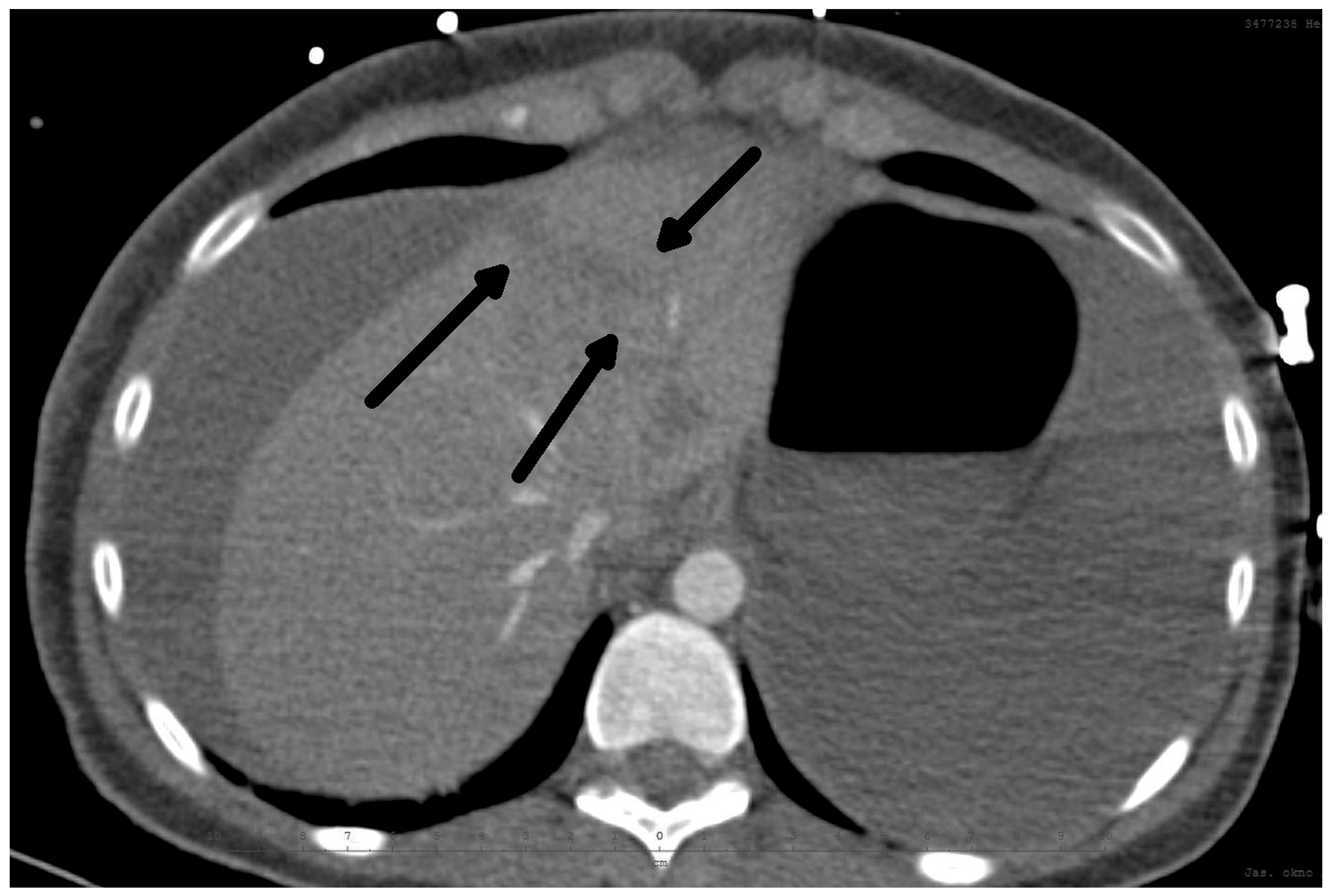 Medicina 60 01470 g001