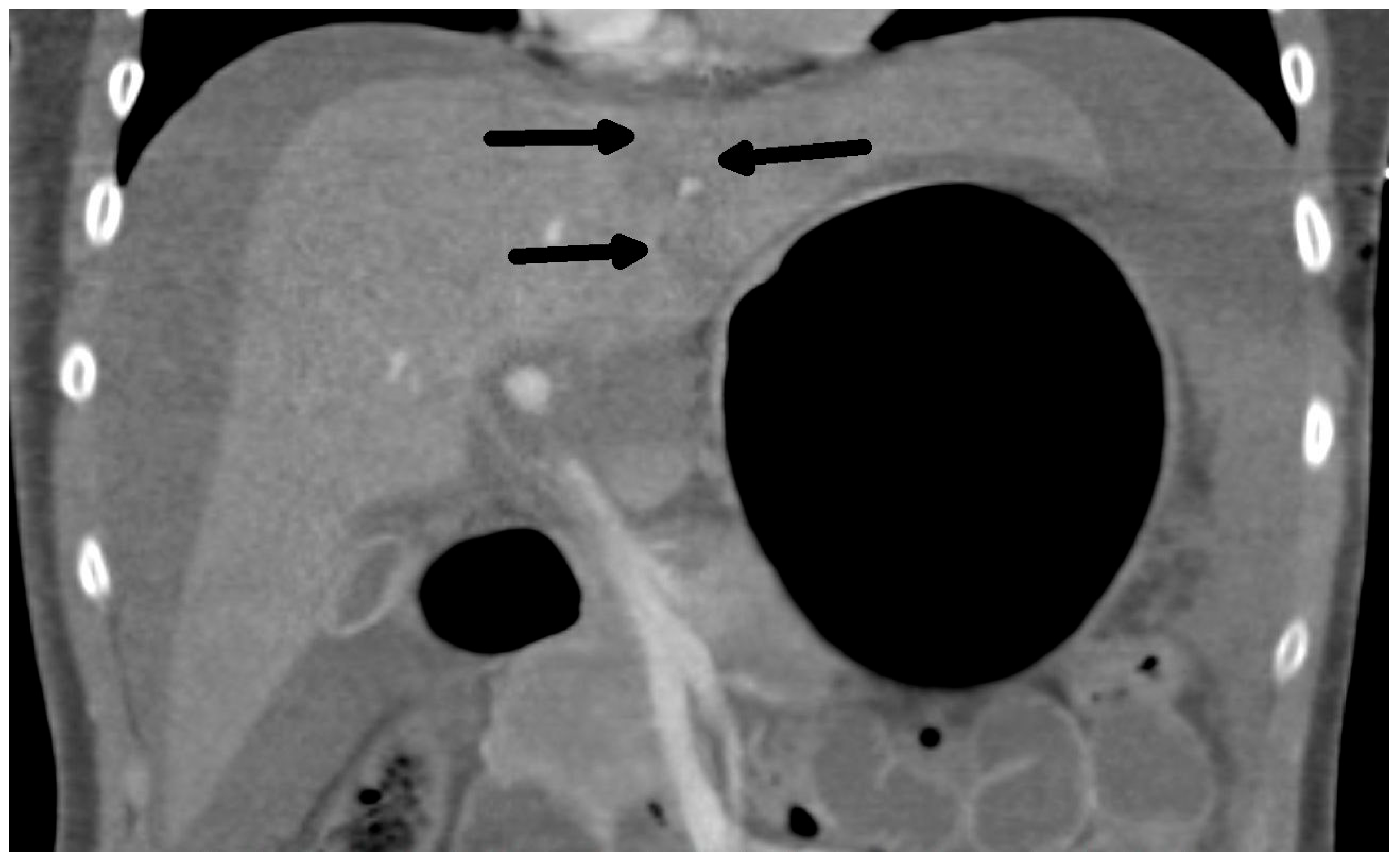 Medicina 60 01470 g002
