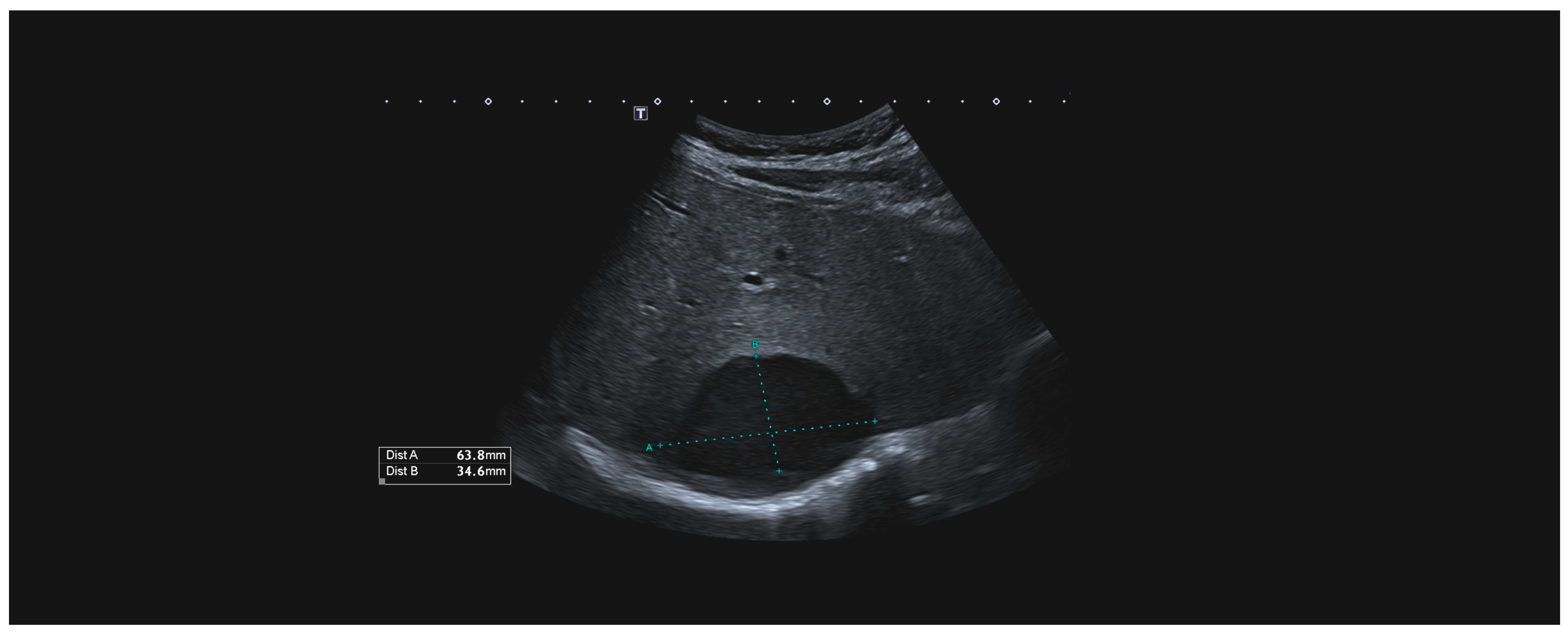 Medicina 60 01470 g004